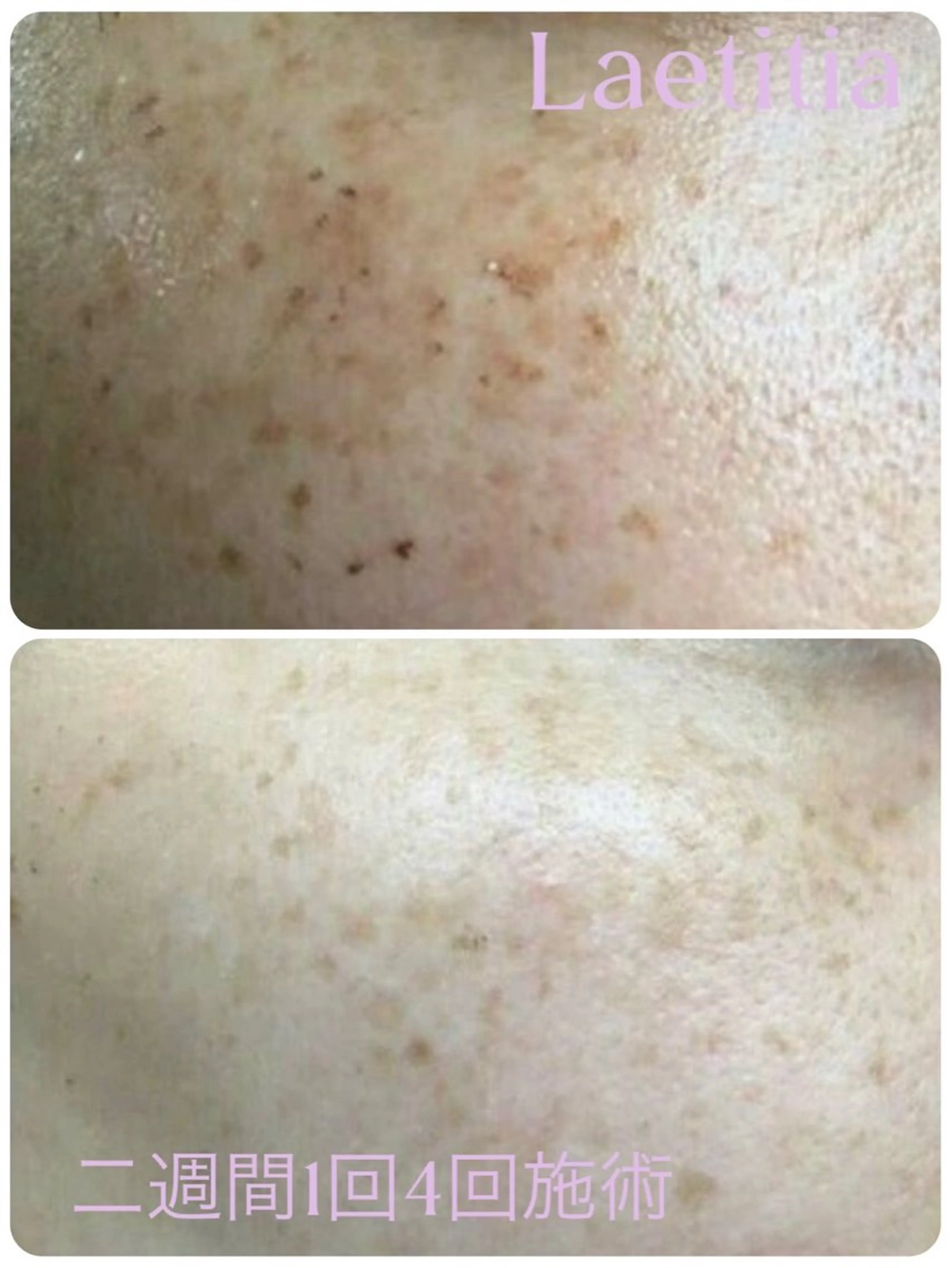 エステ レティティア秋葉原店 Yoshizawaのエステ・リラクイメージ