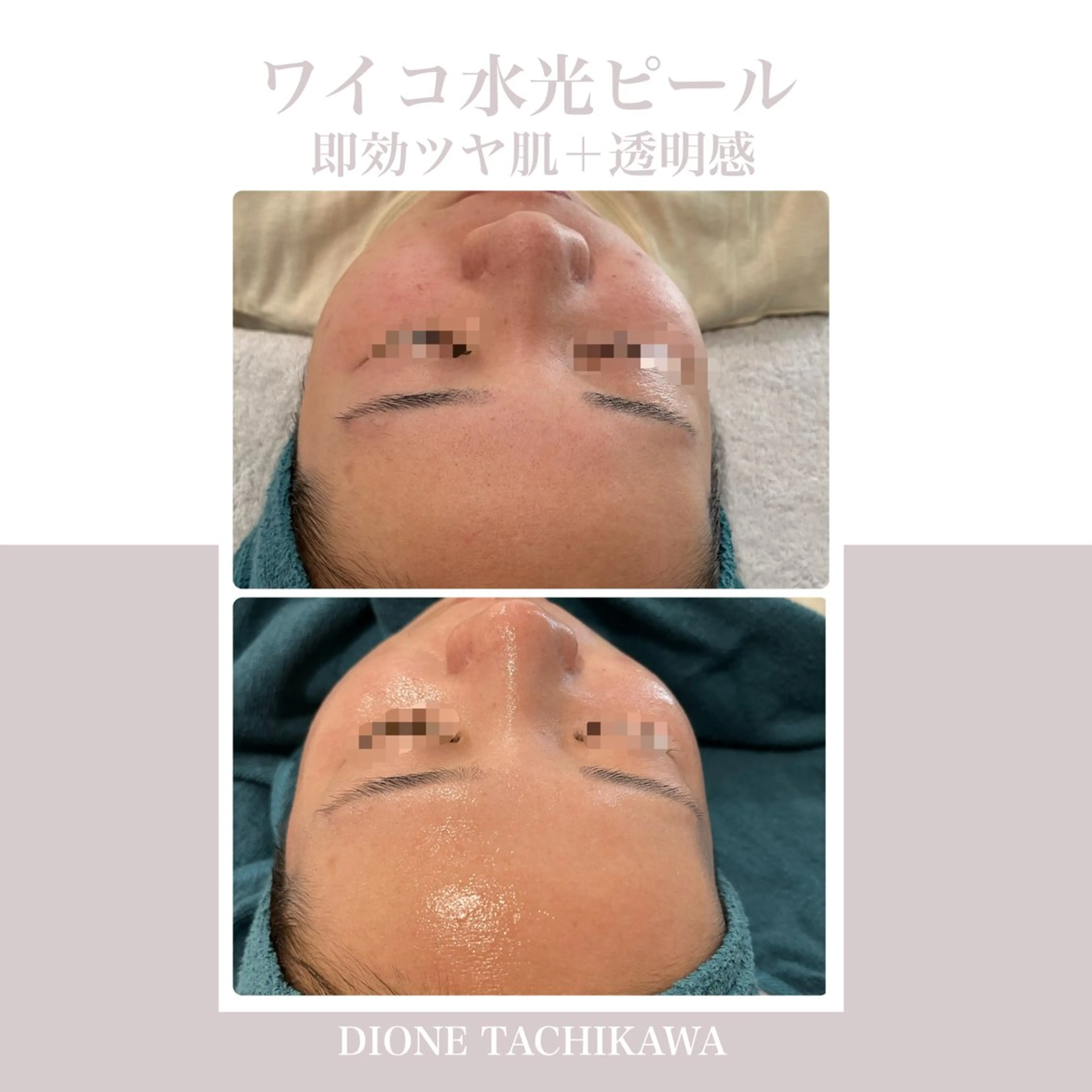 エステ 【リベルハーブピーリング認定店】敏感肌・美白脱毛専門店Dione立川店所属・Dione 立川店のエステ・リラクイメージ