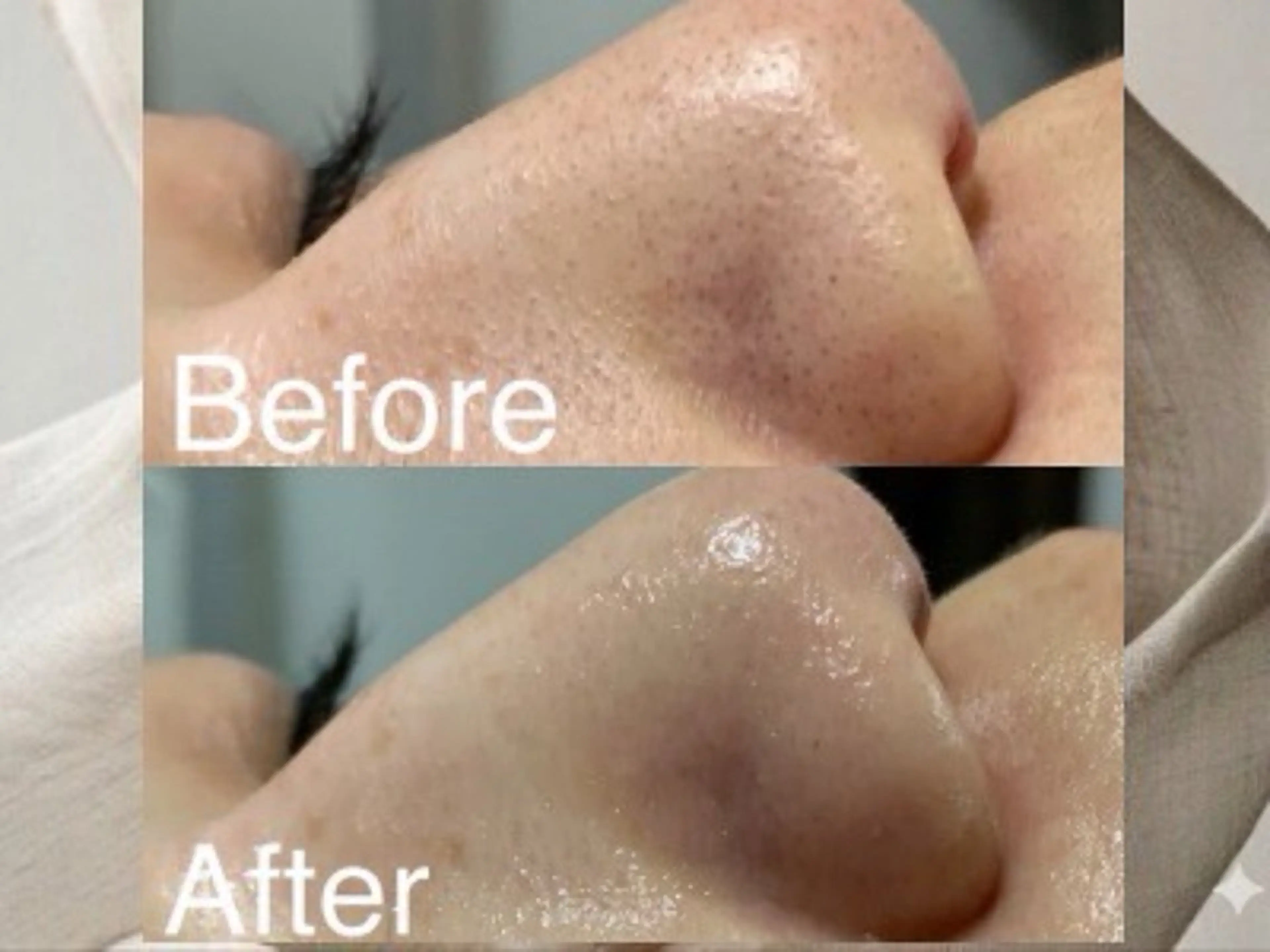 エステ 小顔・毛穴/ニキビ/ ハーブピーリング専門のエステ・リラクイメージ