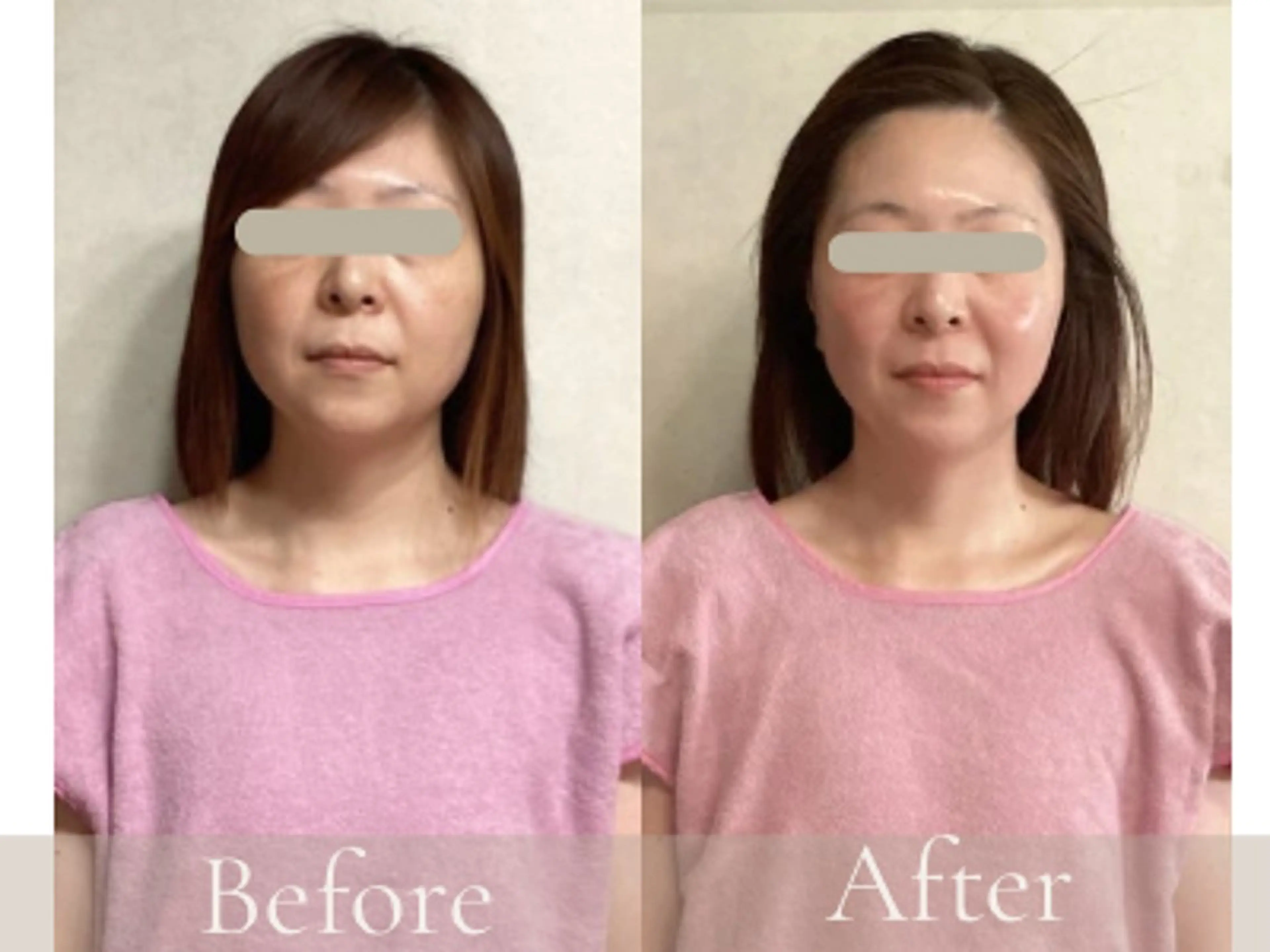 エステ リラク Le Tiarre ル・ティアレのエステ・リラクイメージ