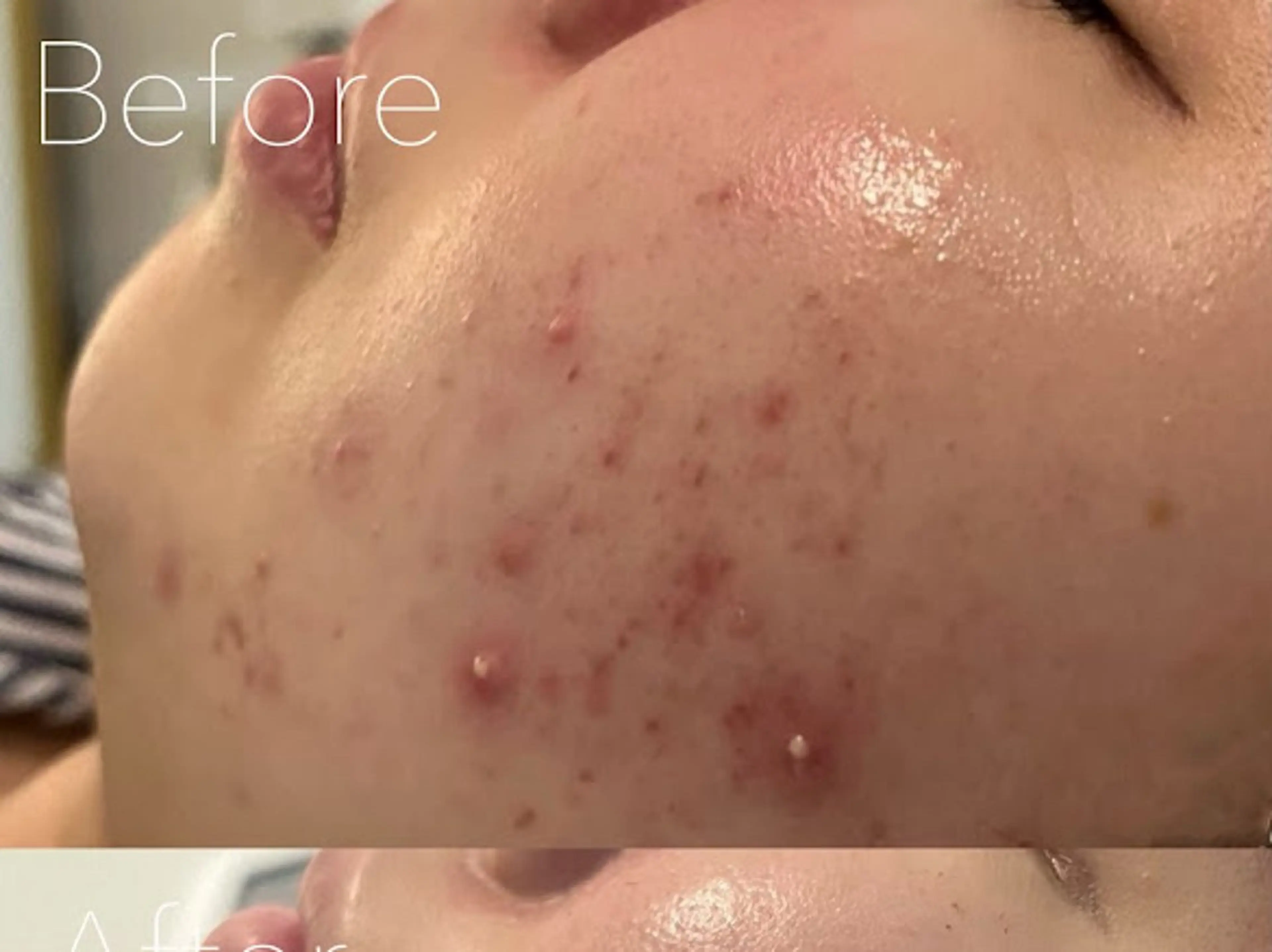 エステ 韓国肌管理Belle 神戸元町のエステ・リラクイメージ