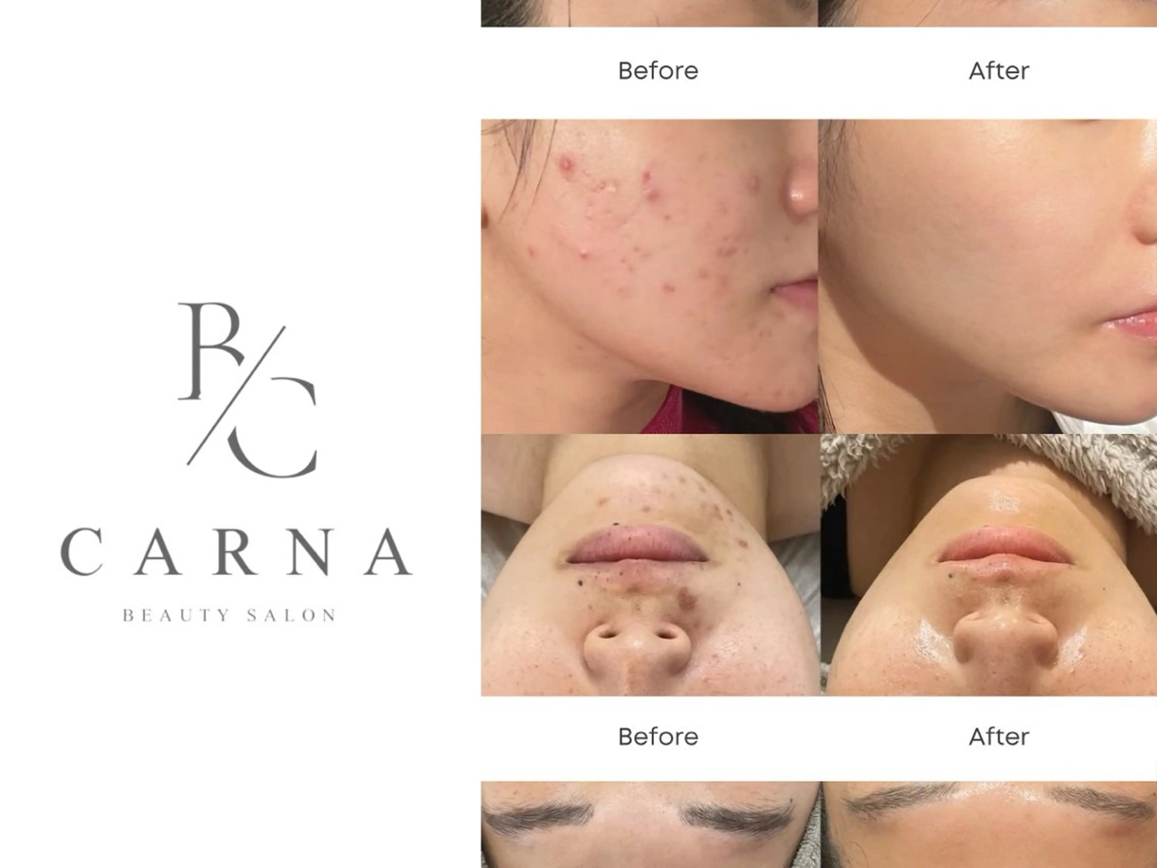 CARNA所属・【肌質改善専門店】 CARNAのエステ・リラクイメージ