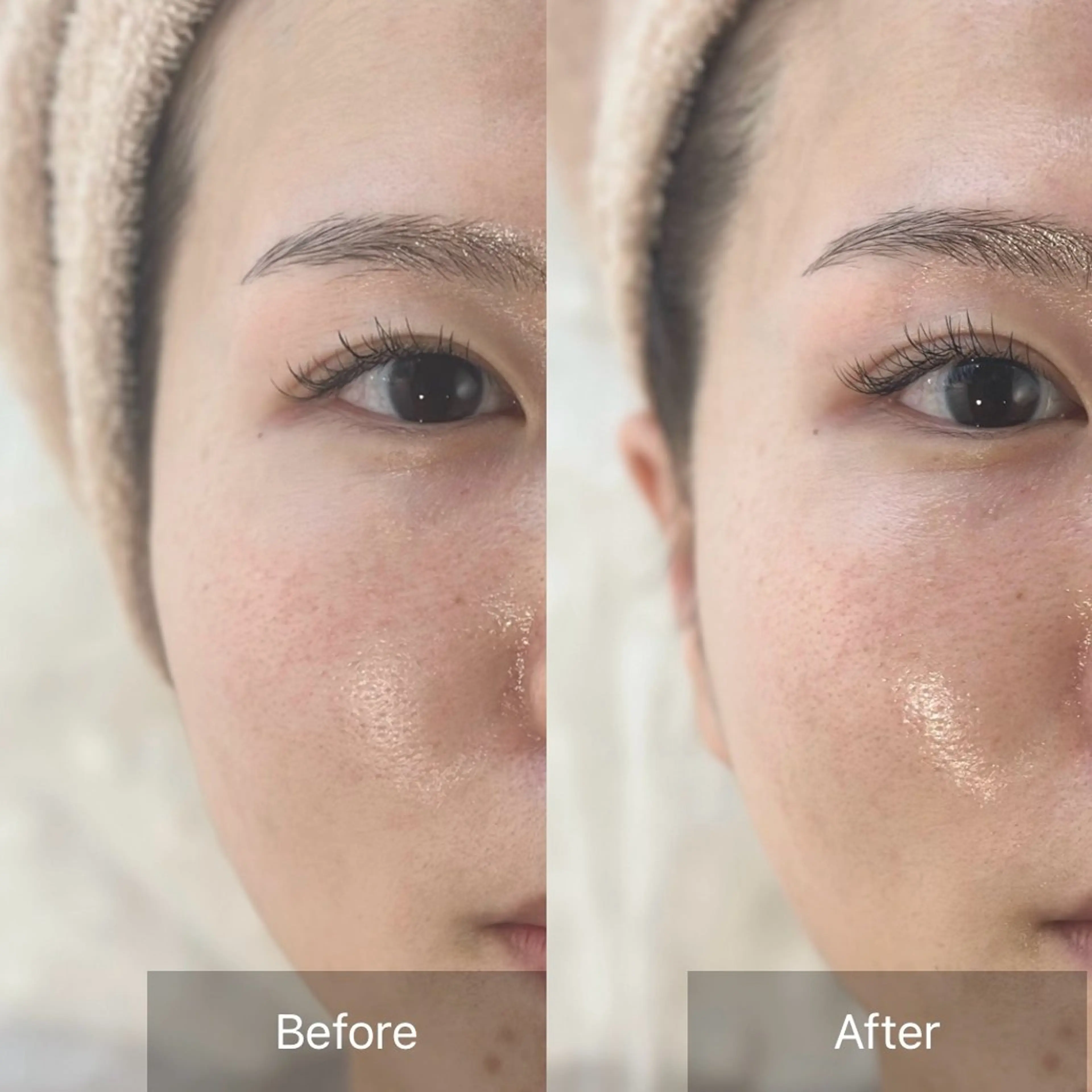 小顔×再生フェイシャルの写真