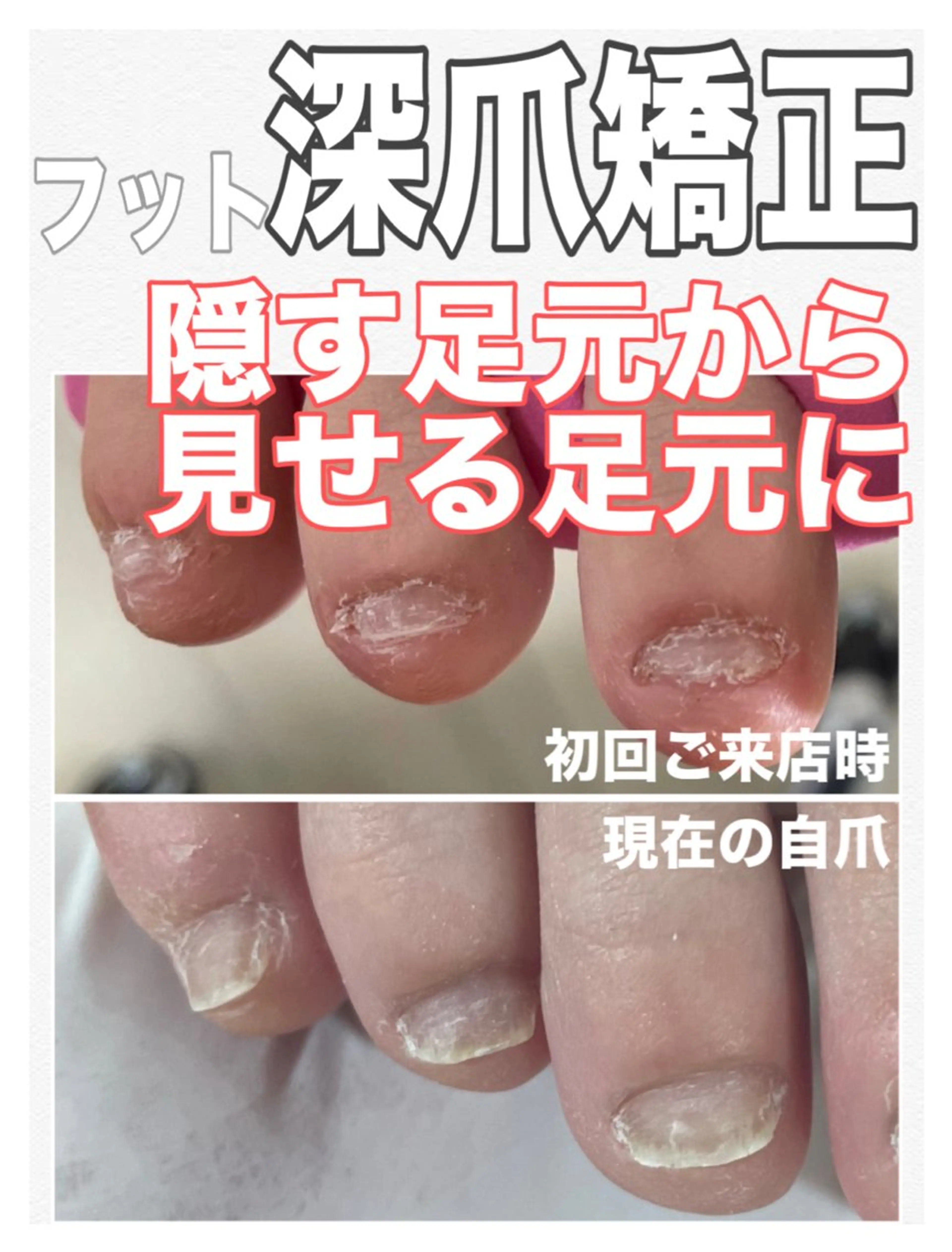 ネイル アートネイル フットネイル nail salon petillantのネイルデザイン