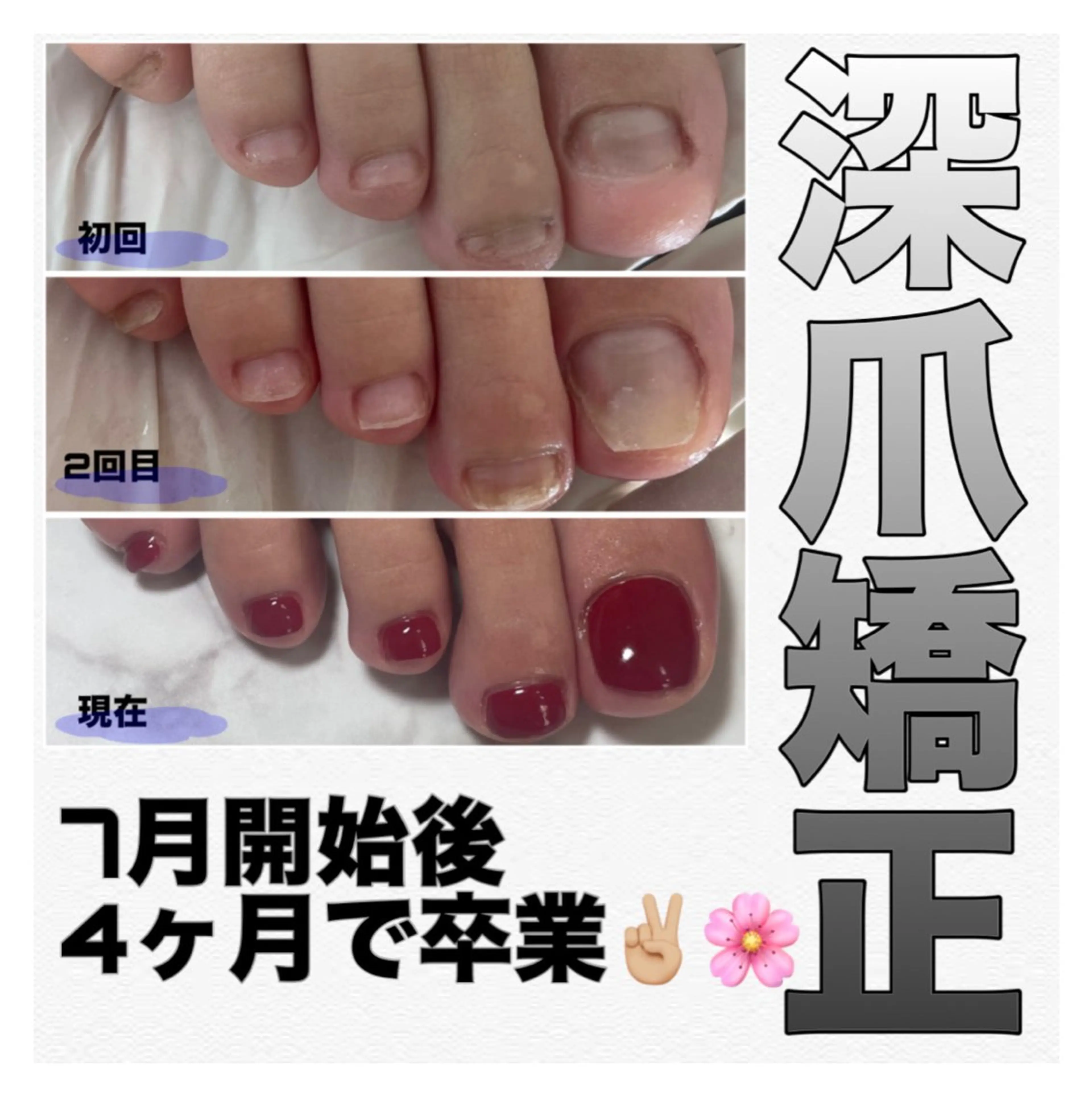 ネイル 長さ出し ジェルネイル 卒業式 ハンドネイル ハンドケア nail salon petillantのネイルデザイン