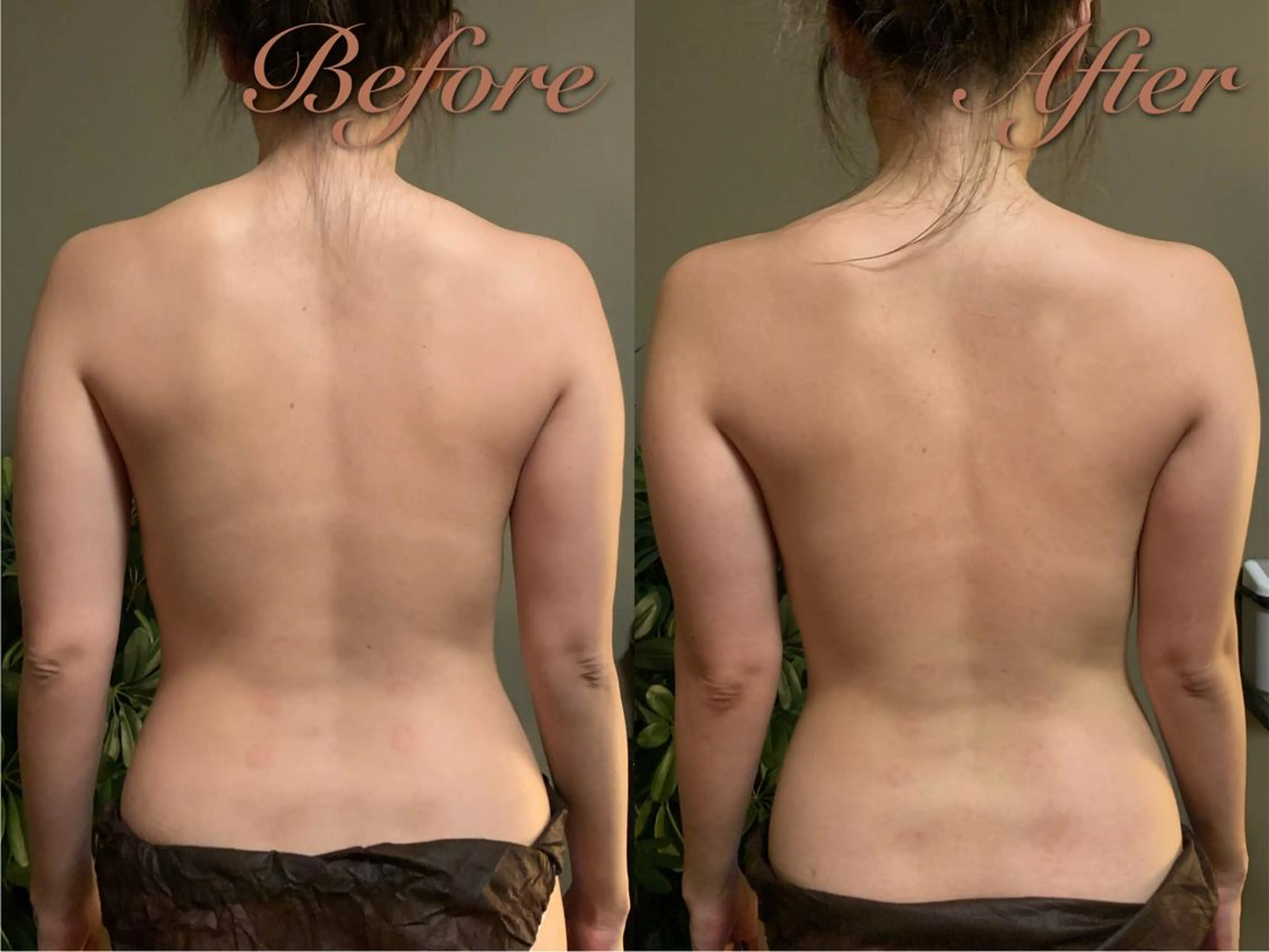 lymph care 'Welnəsのエステ・リラクイメージ