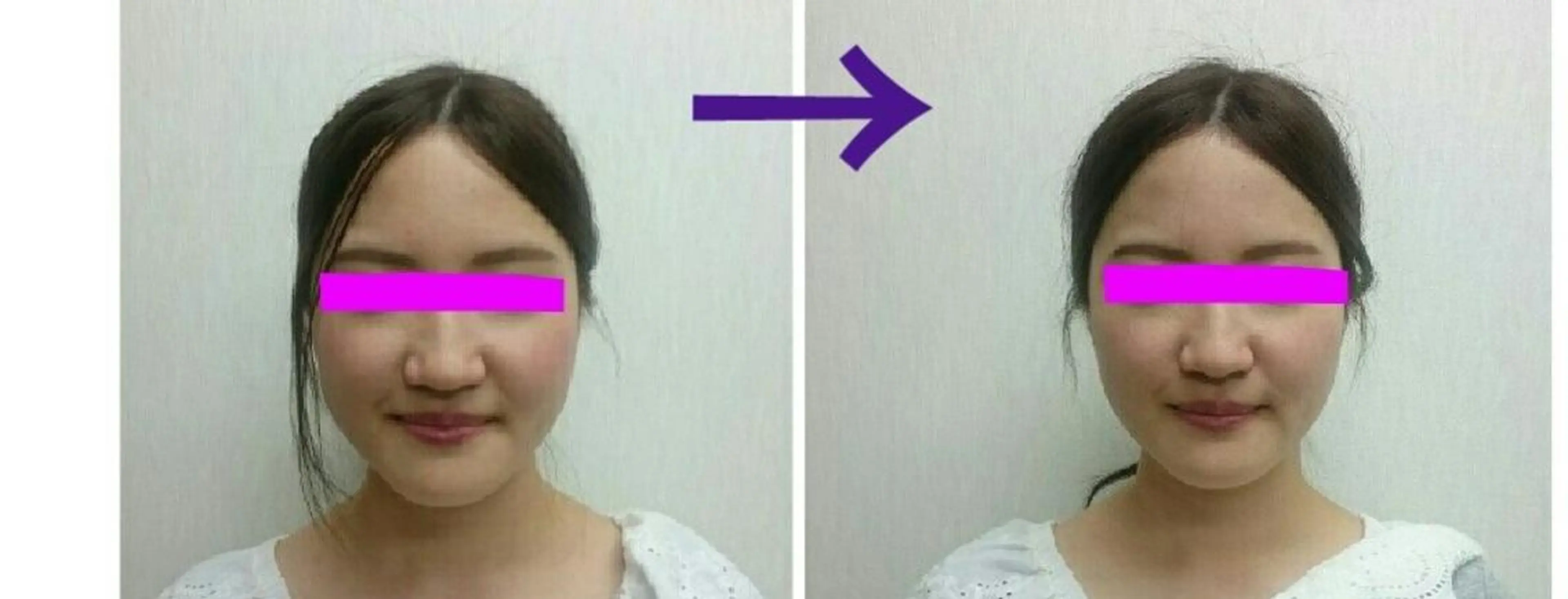 小顔矯正 頭痛専門のブライト整体 所属・ブライト整体🟠 肩こり•腰痛•首こりのエステ・リラクイメージ