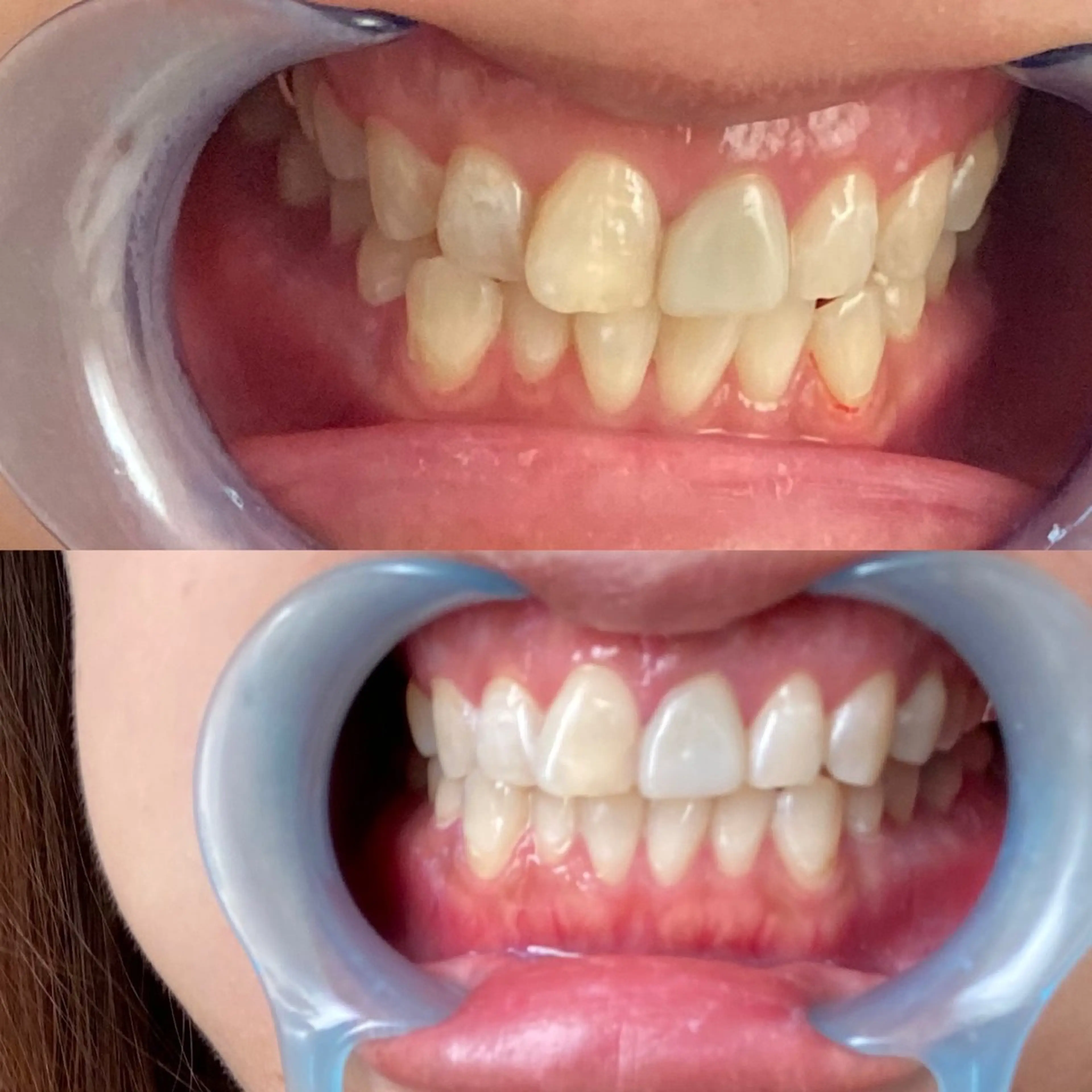 R E O T I A R A（レオティアラ）所属・高屋 昌子のその他イメージ