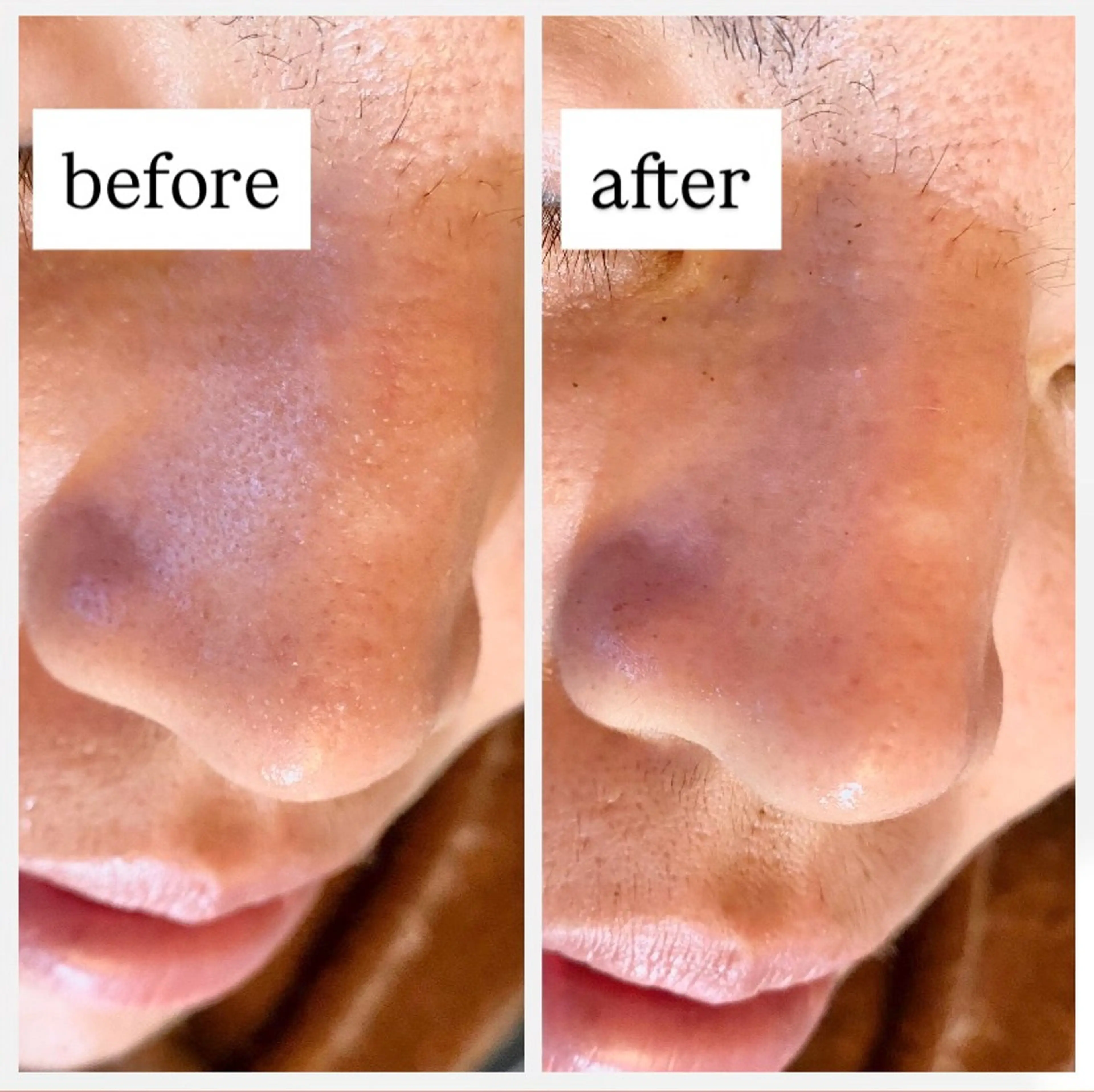 肌質改善専門 ハーブ /毛穴洗浄 リエイトのエステ・リラクイメージ