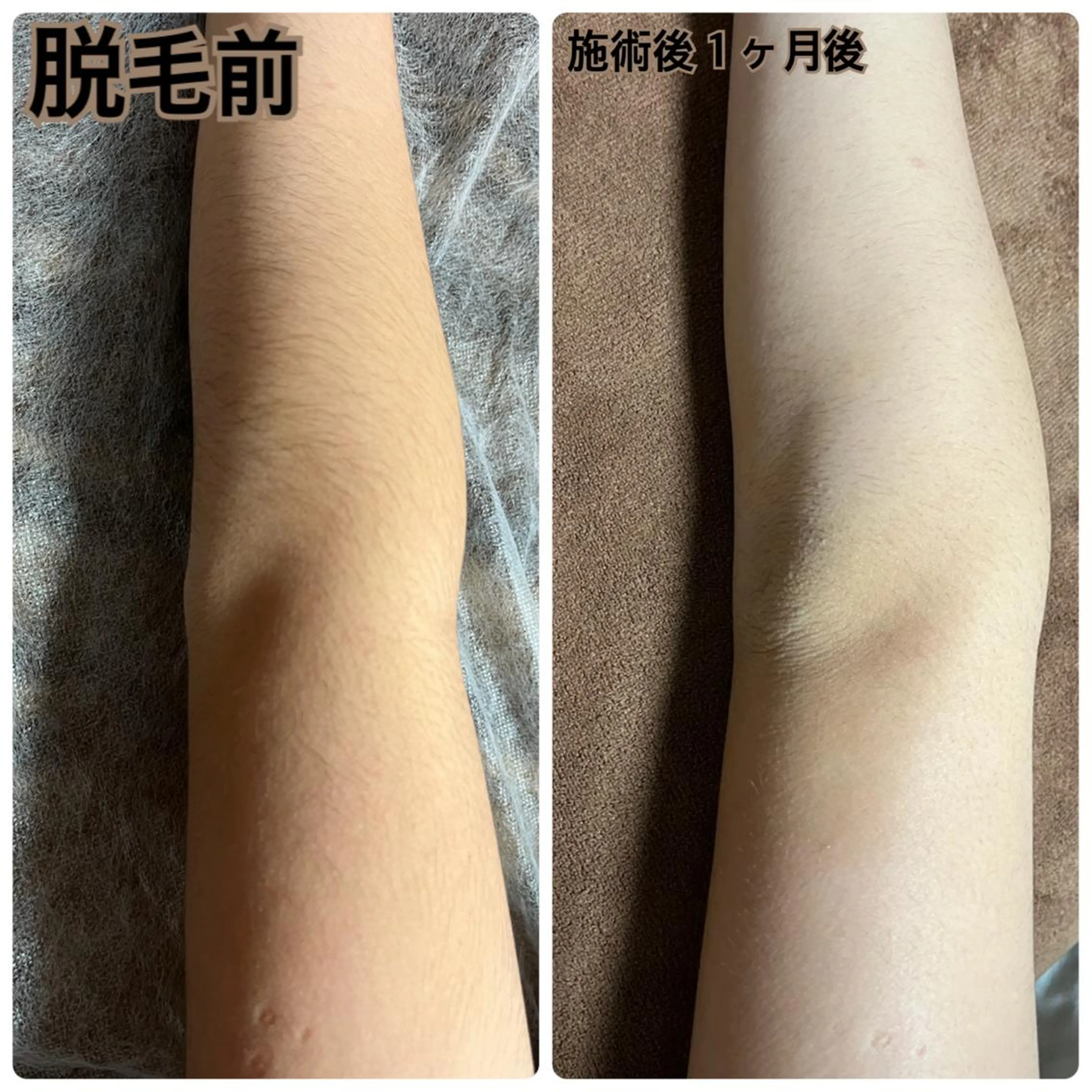 キッズ 脱毛 Puki Puki 脱毛サロンのエステ・リラクイメージ