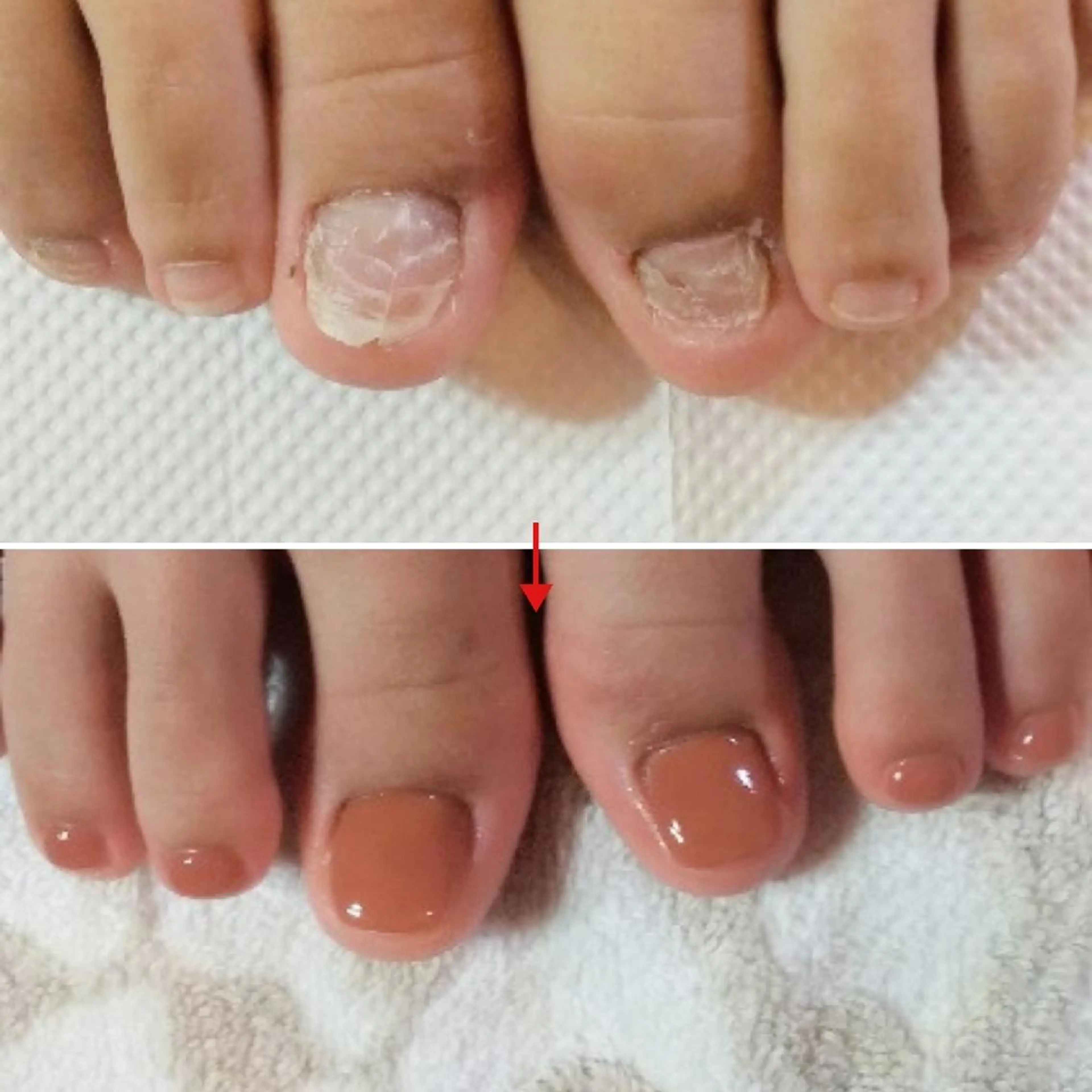 ネイル フットネイル ネイルサロン アリュームのネイルデザイン