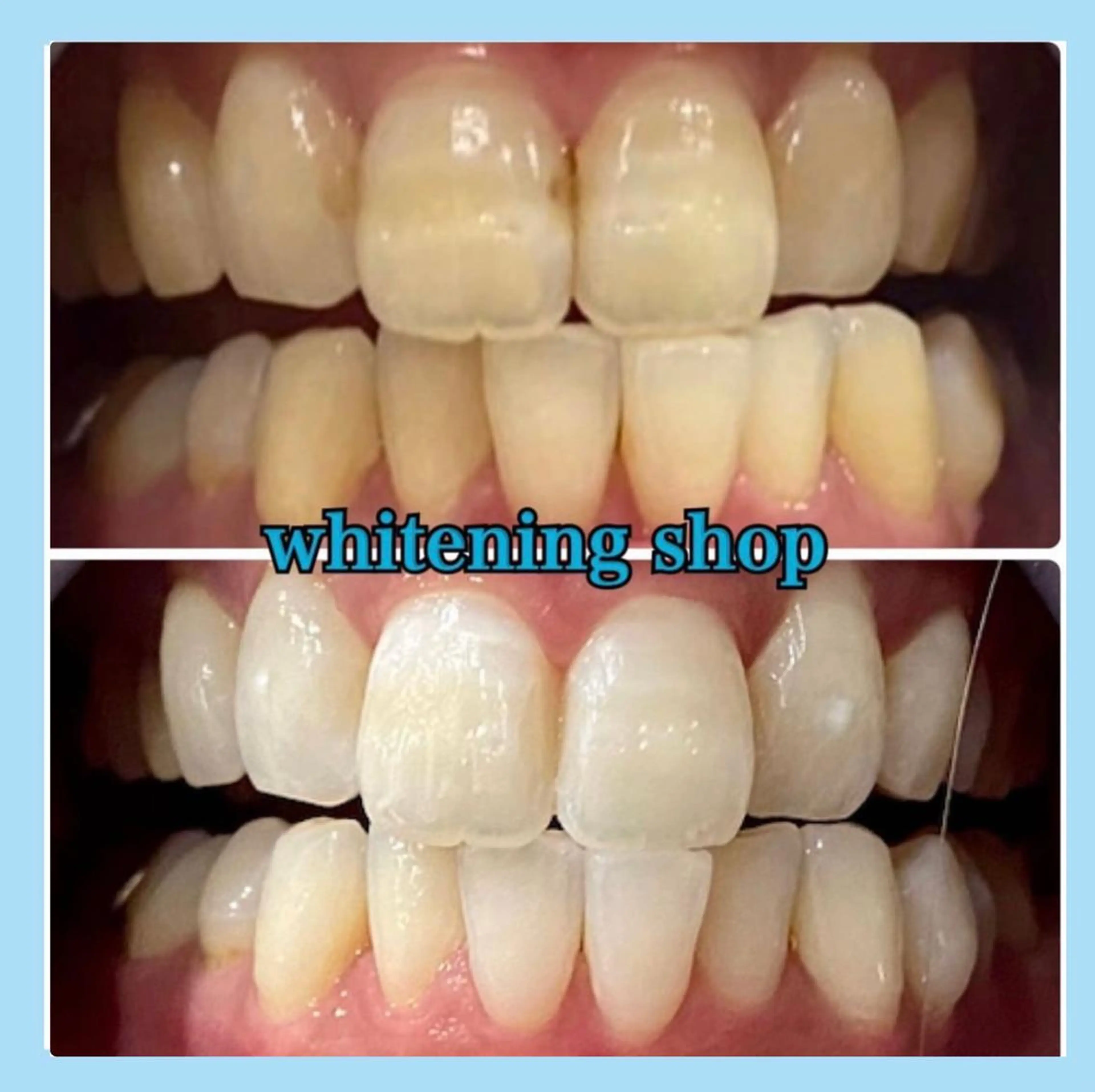 ホワイトニング ショップ千葉店のその他イメージ