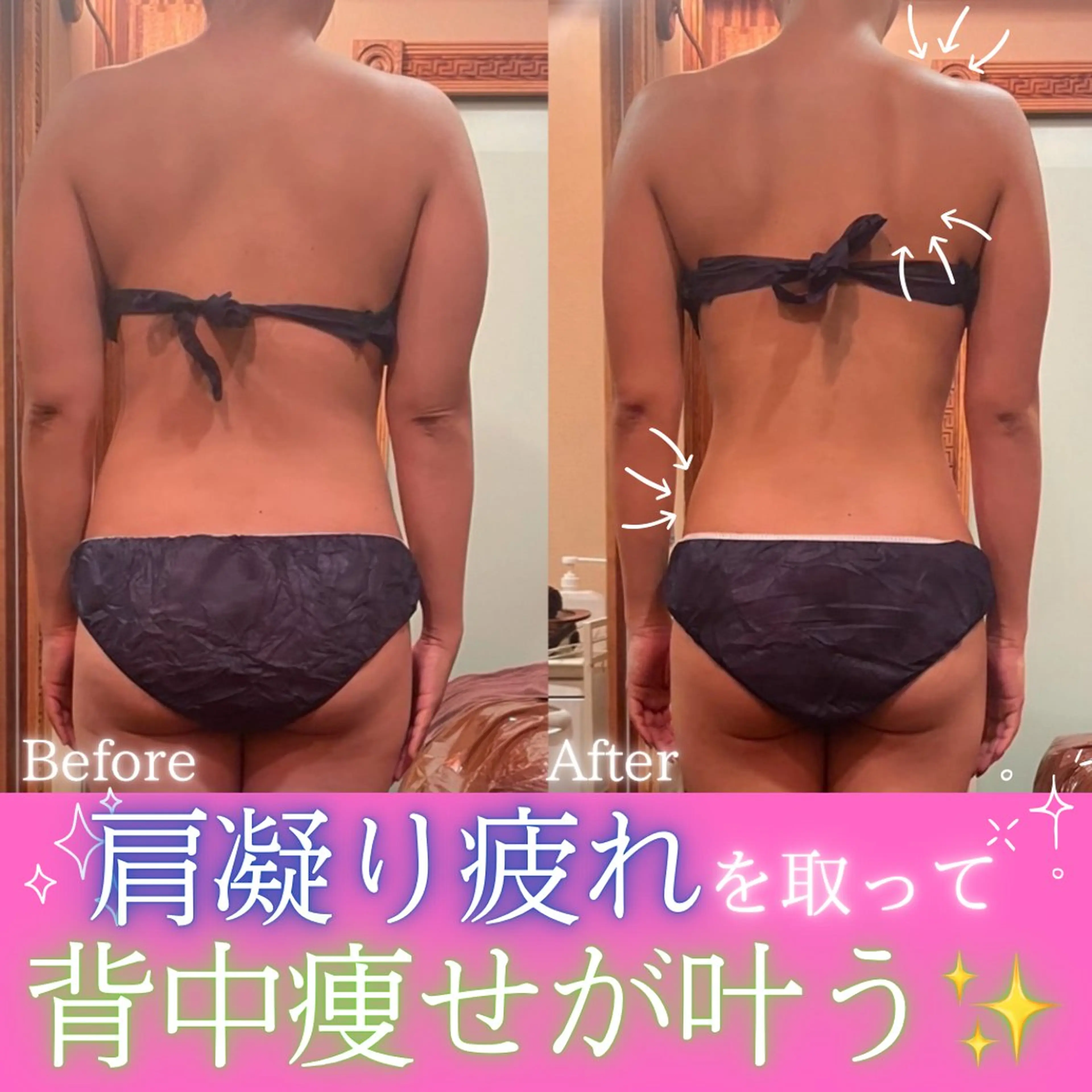 エステ 痩身&美肌サロン 堀米✨のその他イメージ