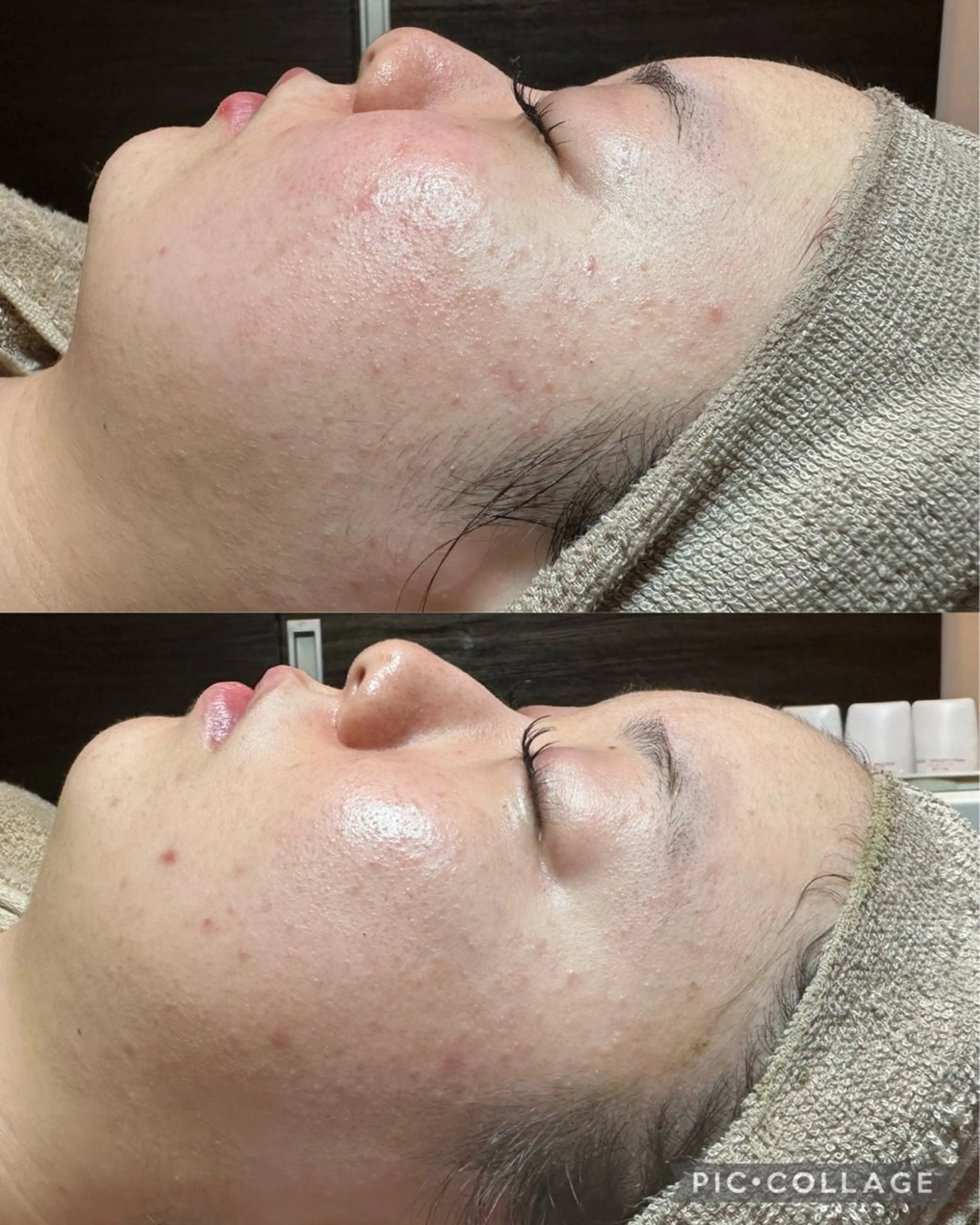 エステ Feel♡ JYURIAのネイルデザイン