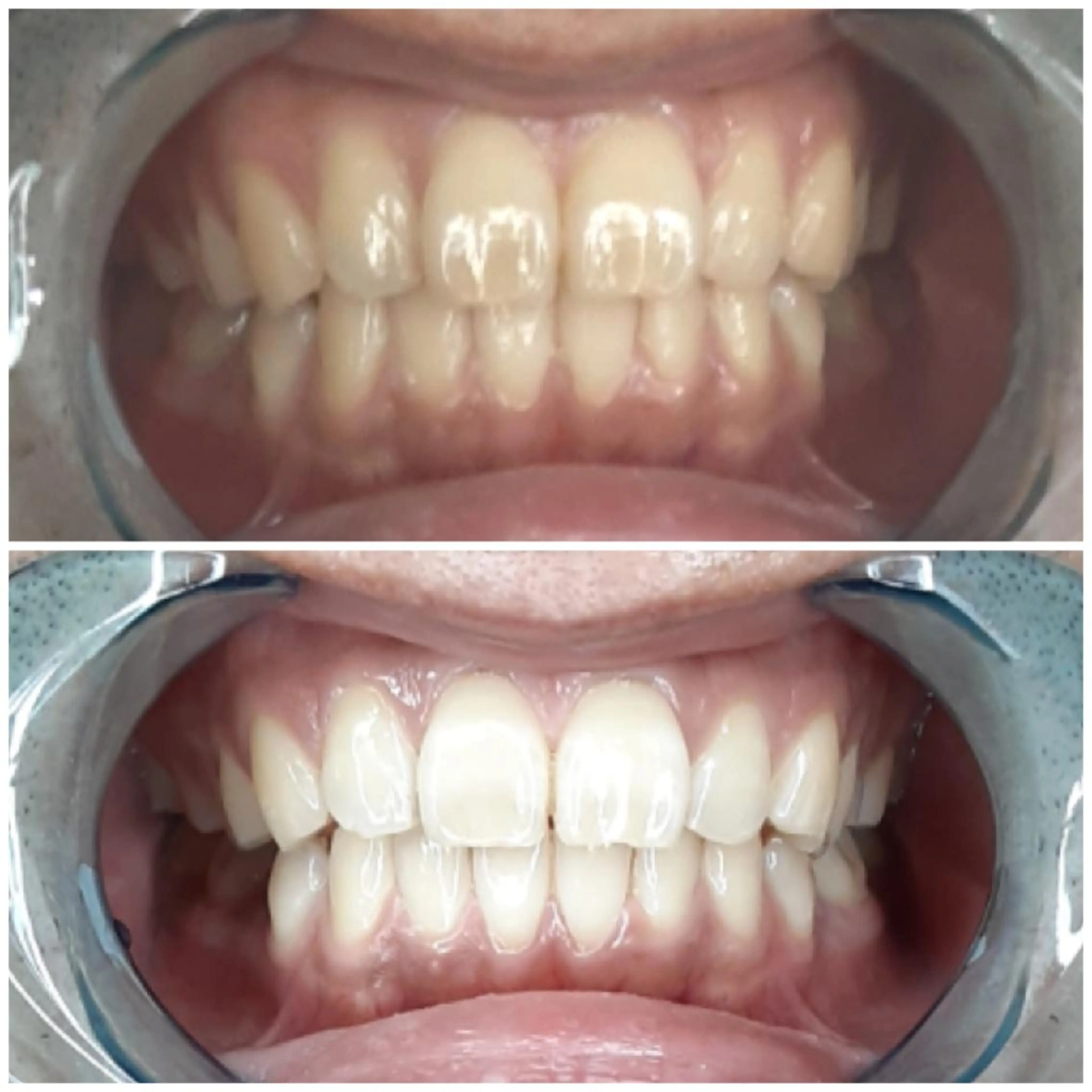 その他 五十嵐 蓮のその他イメージ