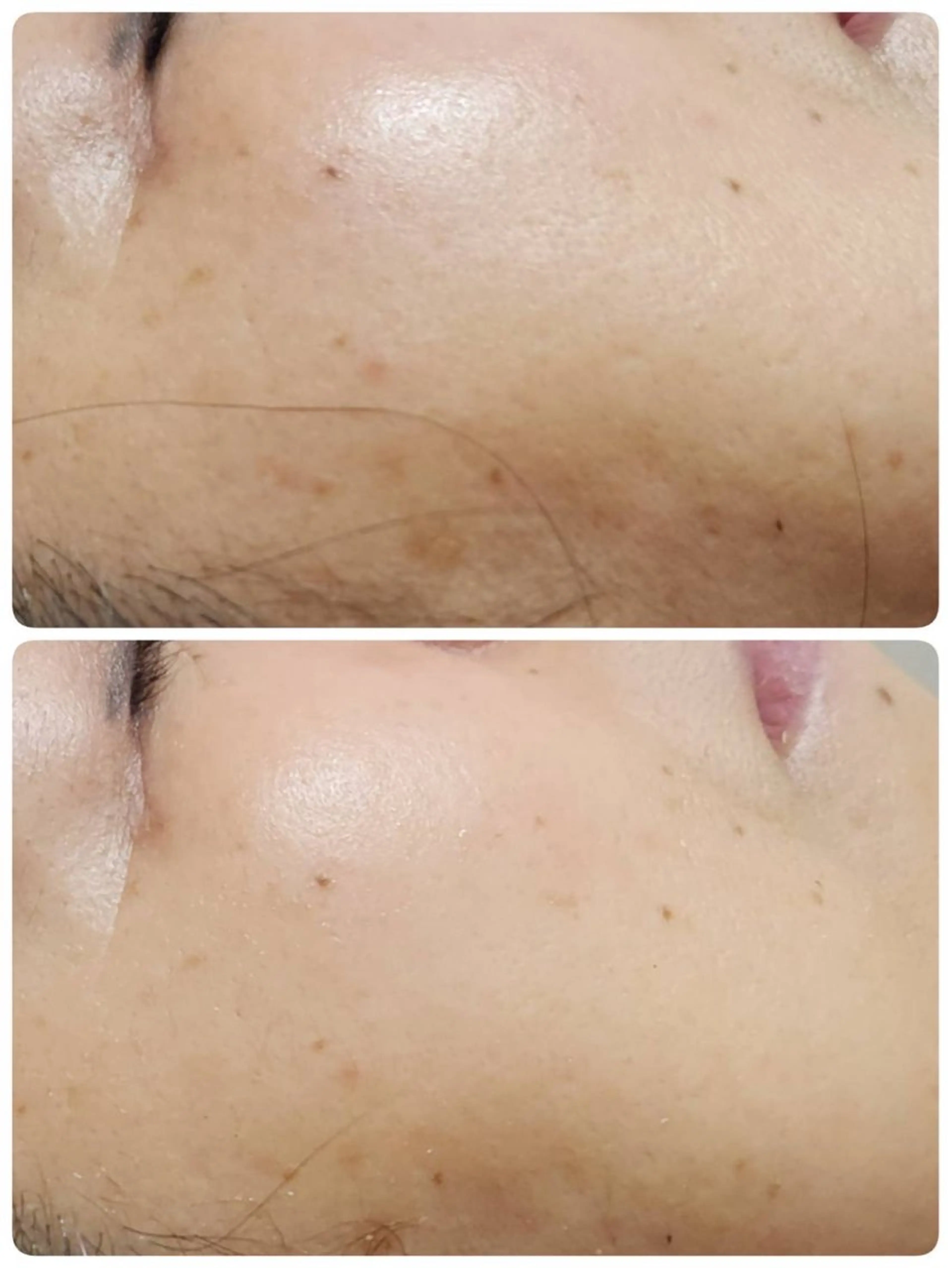 その他 Astorie 相模大野エステのその他イメージ