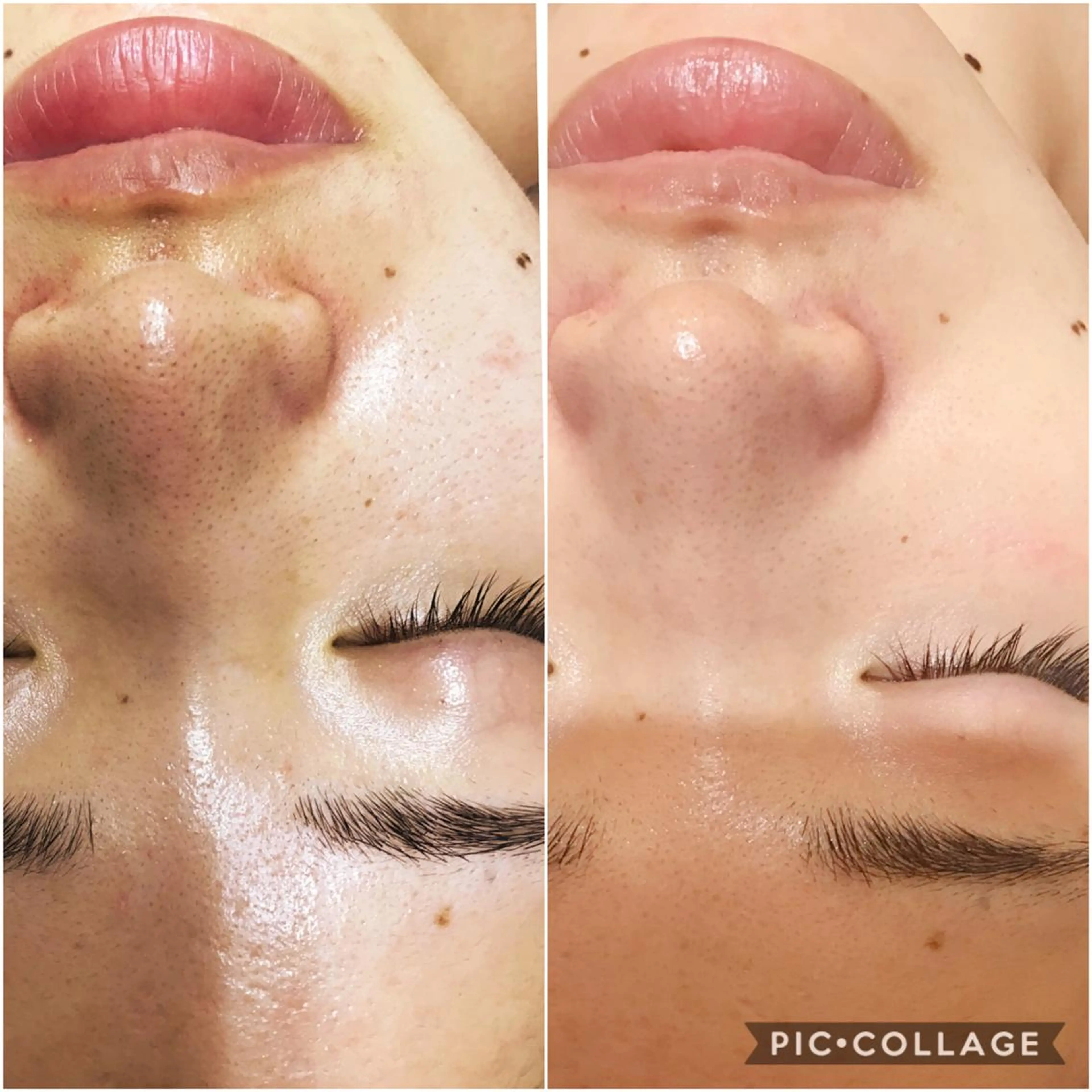 エステ 🧸レイビス💕 sora🧸のエステ・リラクイメージ