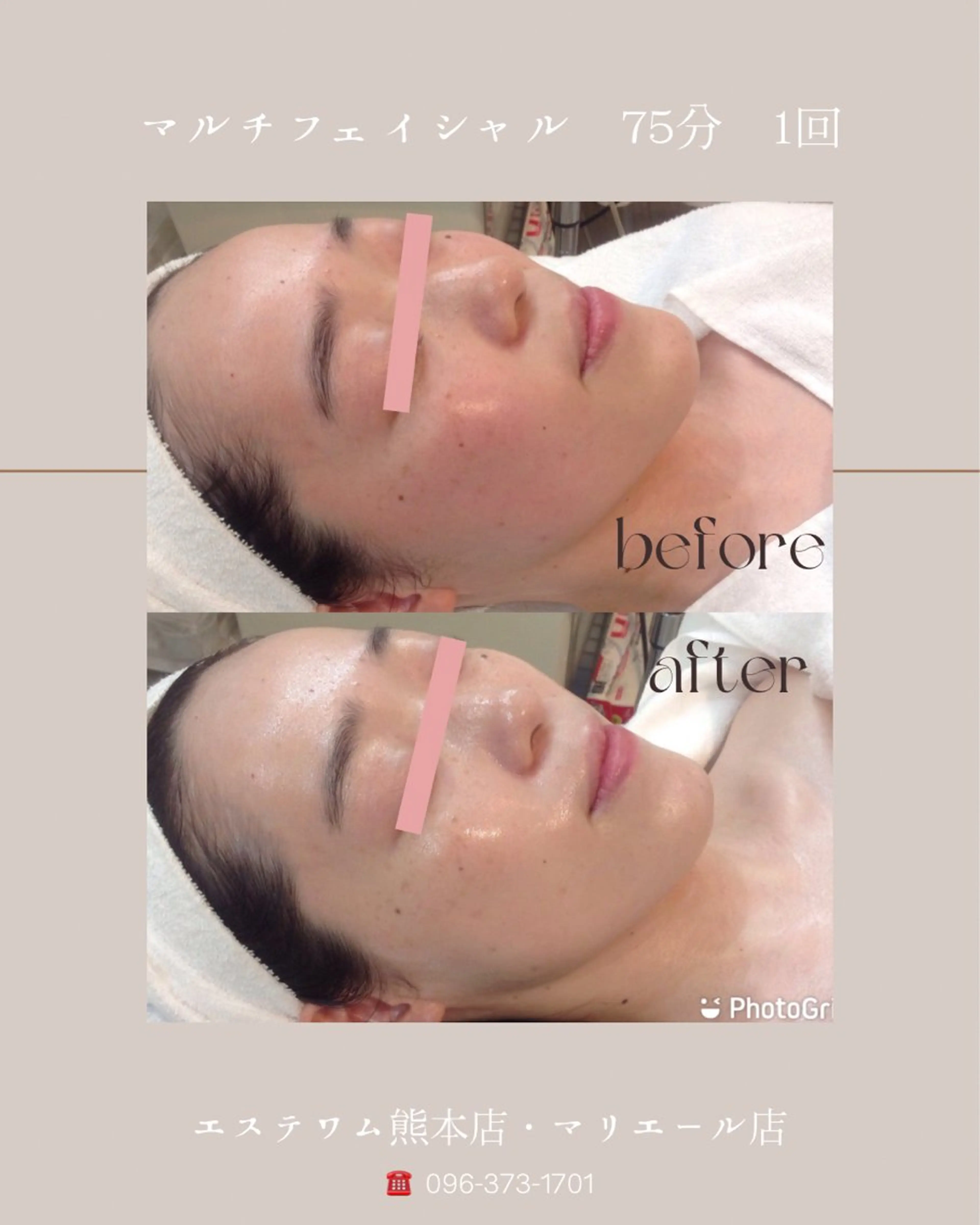 エステ エステWAM 髙木のエステ・リラクイメージ