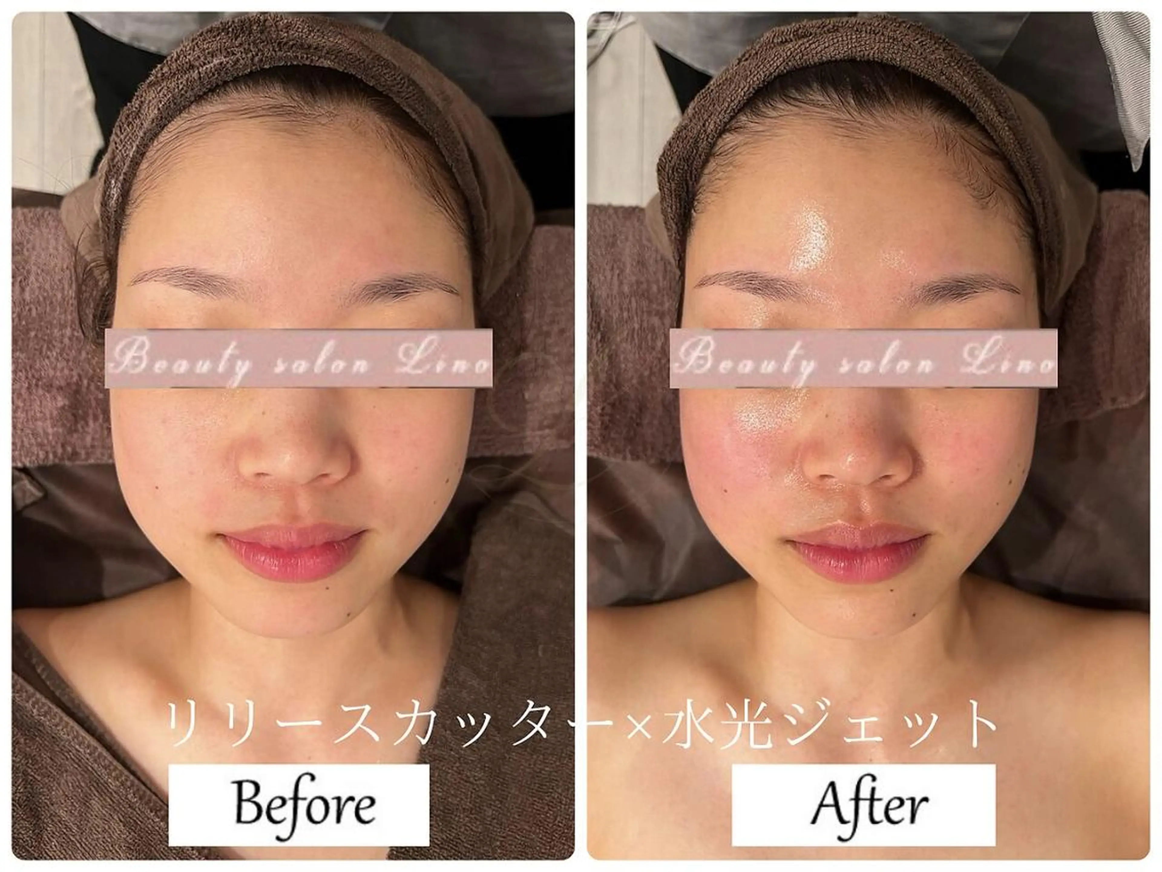 ブライダルサロン ｜Lino【堀江】のエステ・リラクイメージ