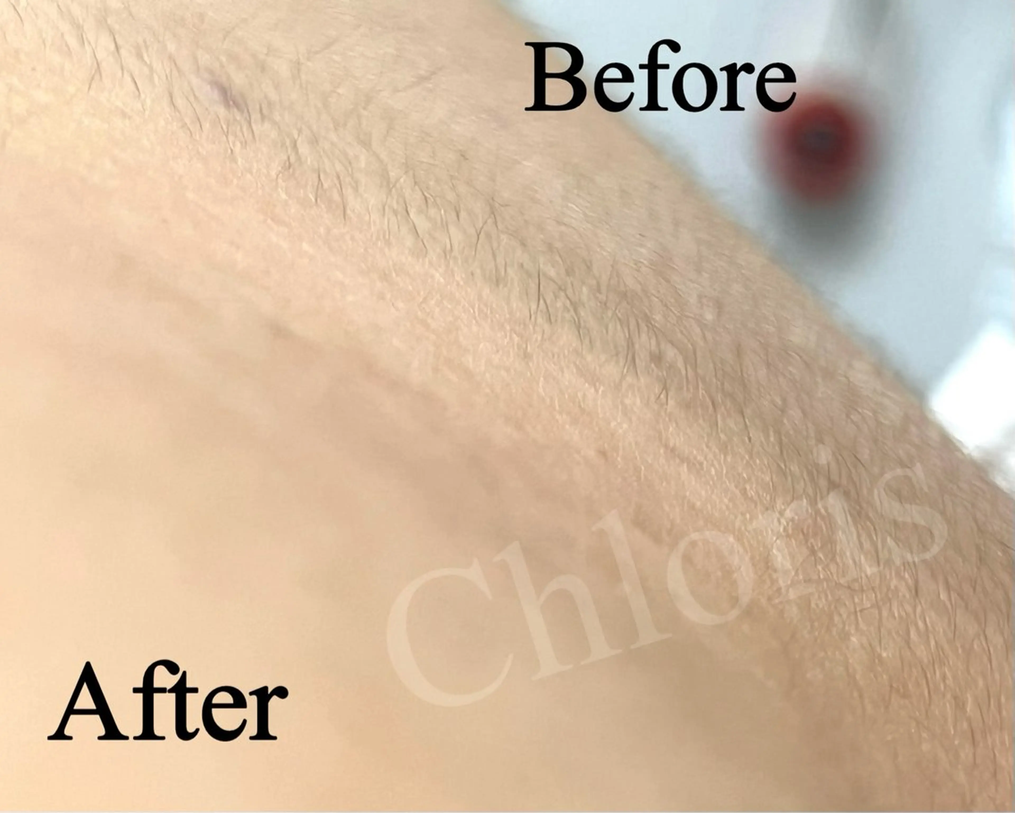 川越デリケートゾーン 光脱毛/ワックス脱毛のエステ・リラクイメージ