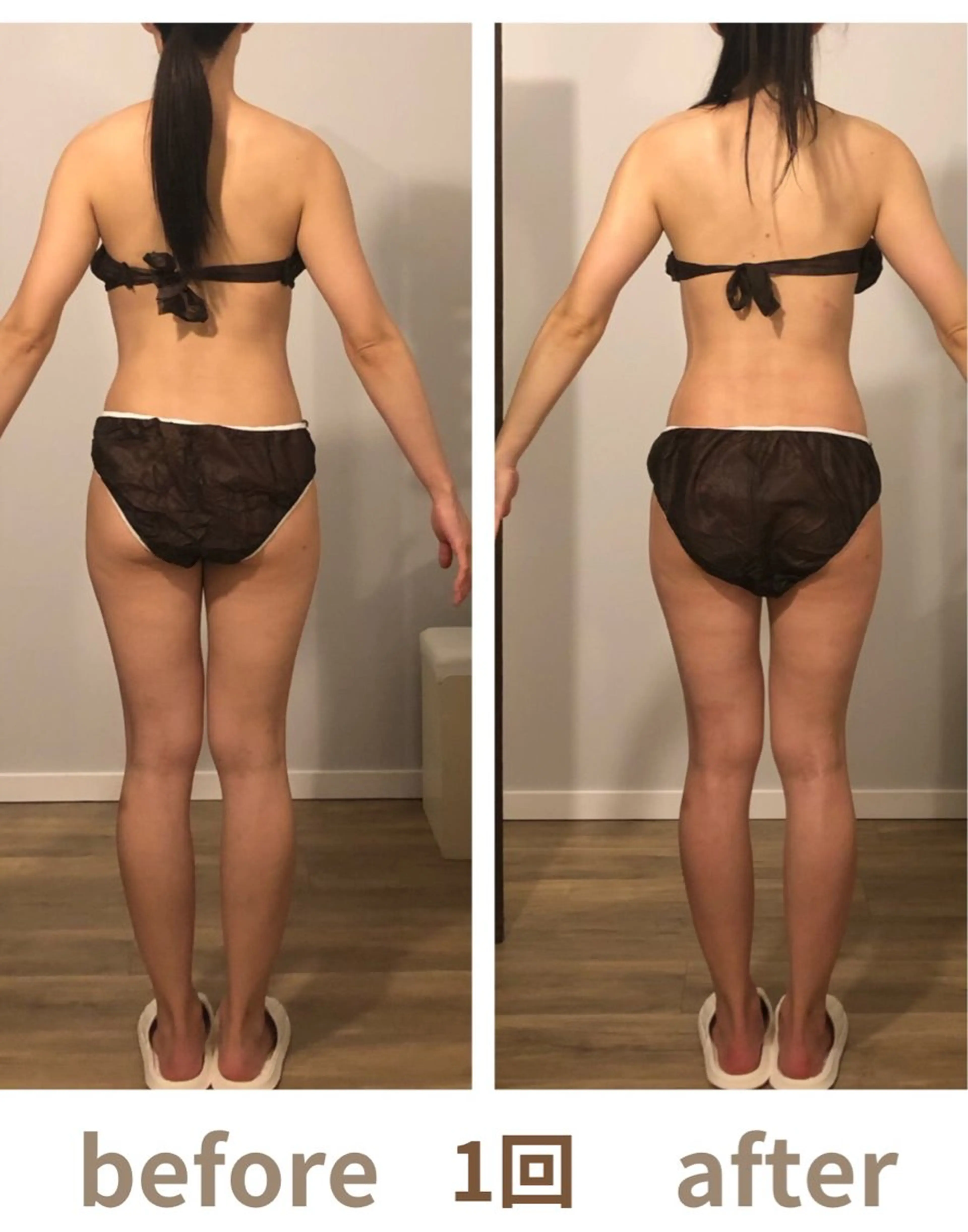 🔥全身体質UPコース90分🔥高出力ラジオ波×痩身ハンド×遠赤マットの写真