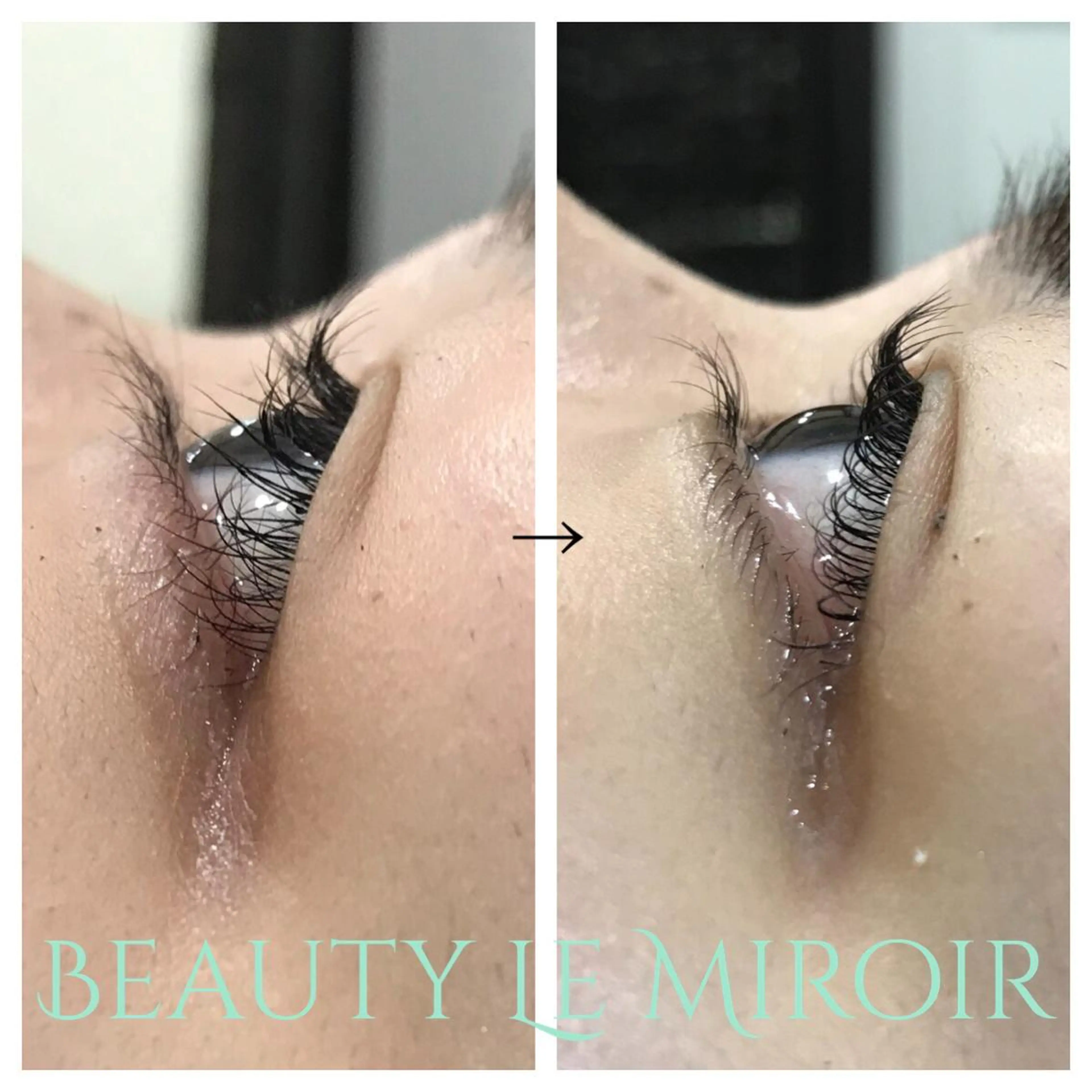 マツエク・マツパ ビューティー ミロワールのエステ・リラクイメージ