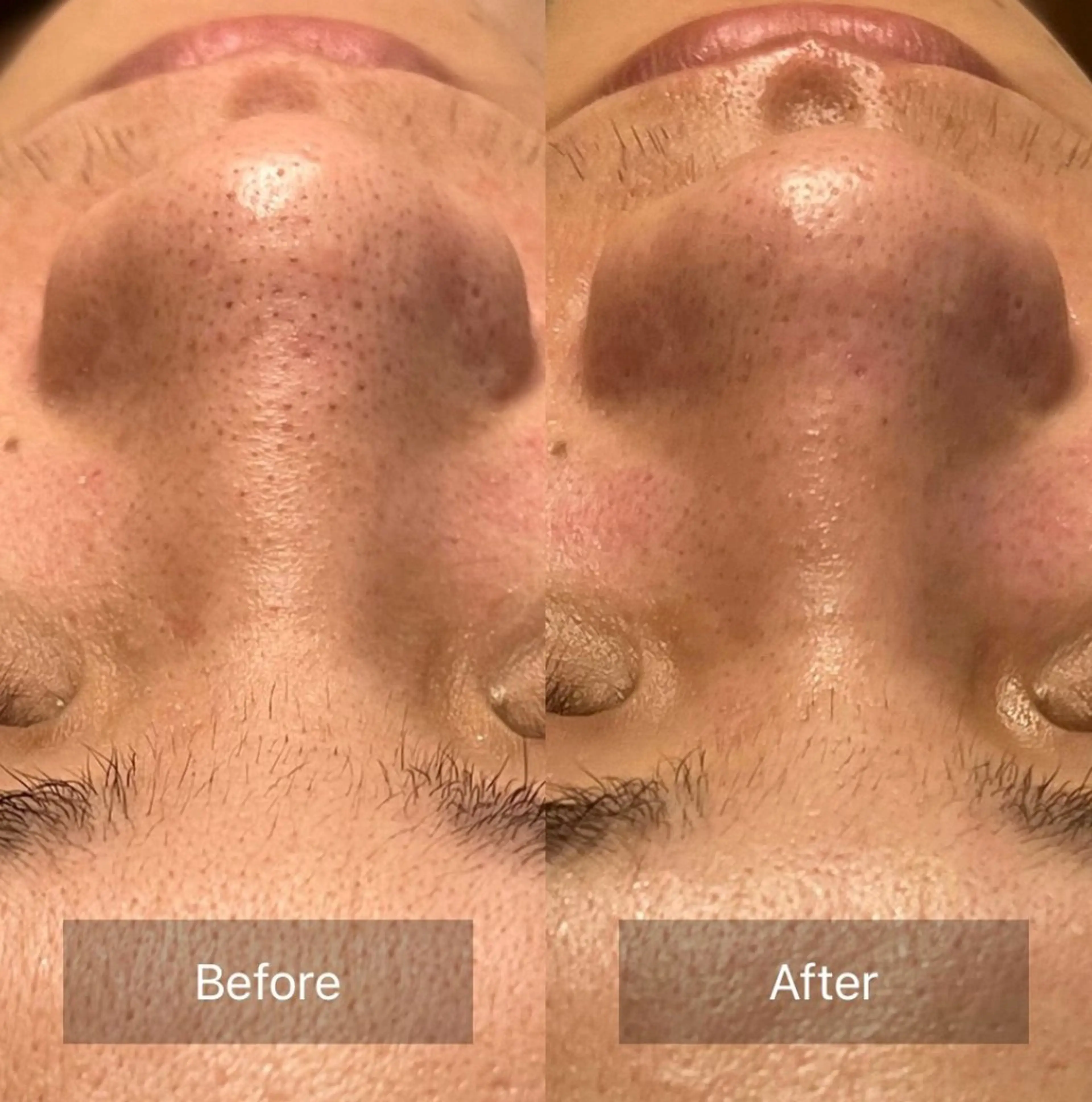 【頭痛、睡眠改善】 salon RUUのエステ・リラクイメージ