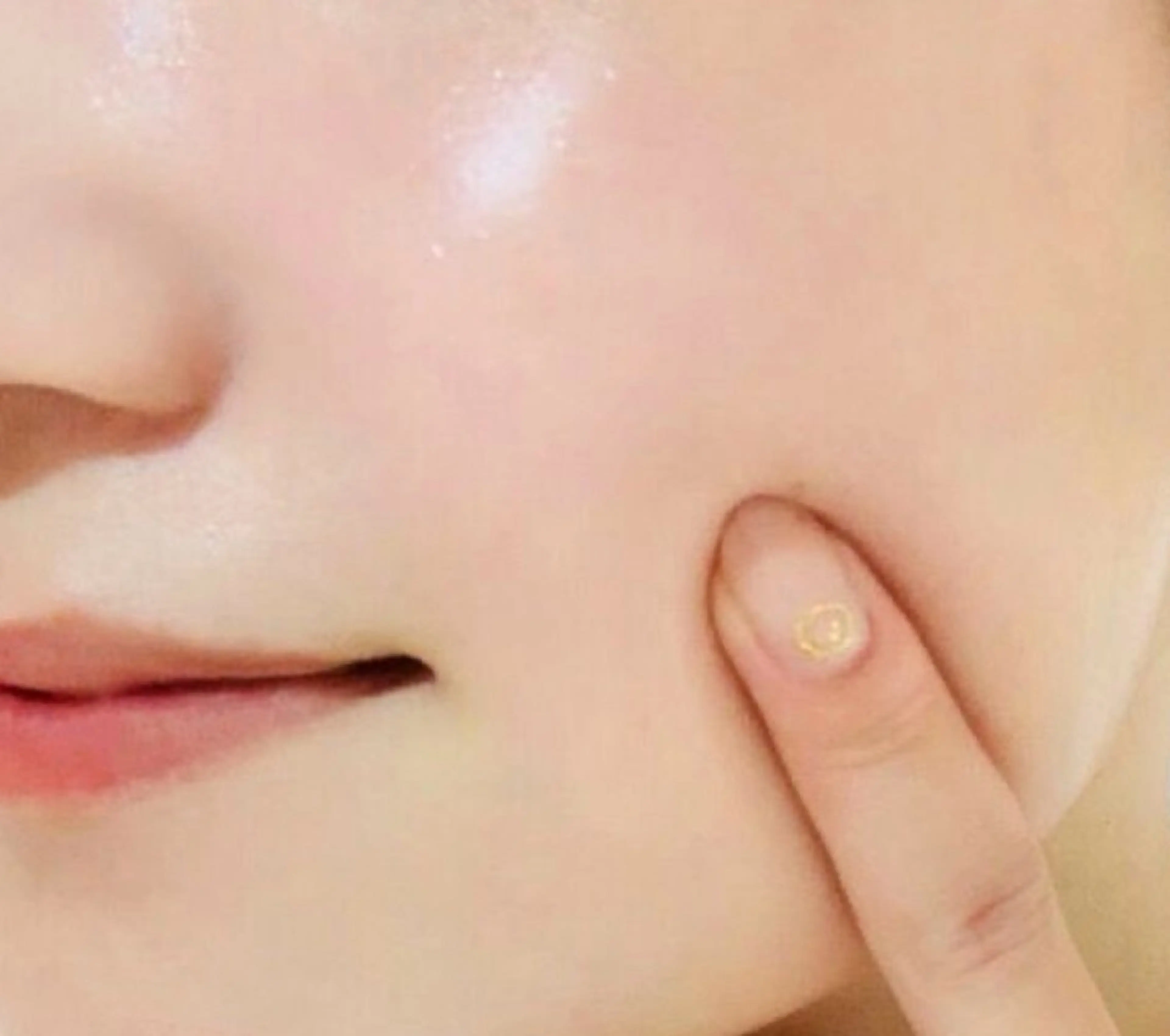 🩵美肌&リフトアップ効果🩵超音波エステの写真