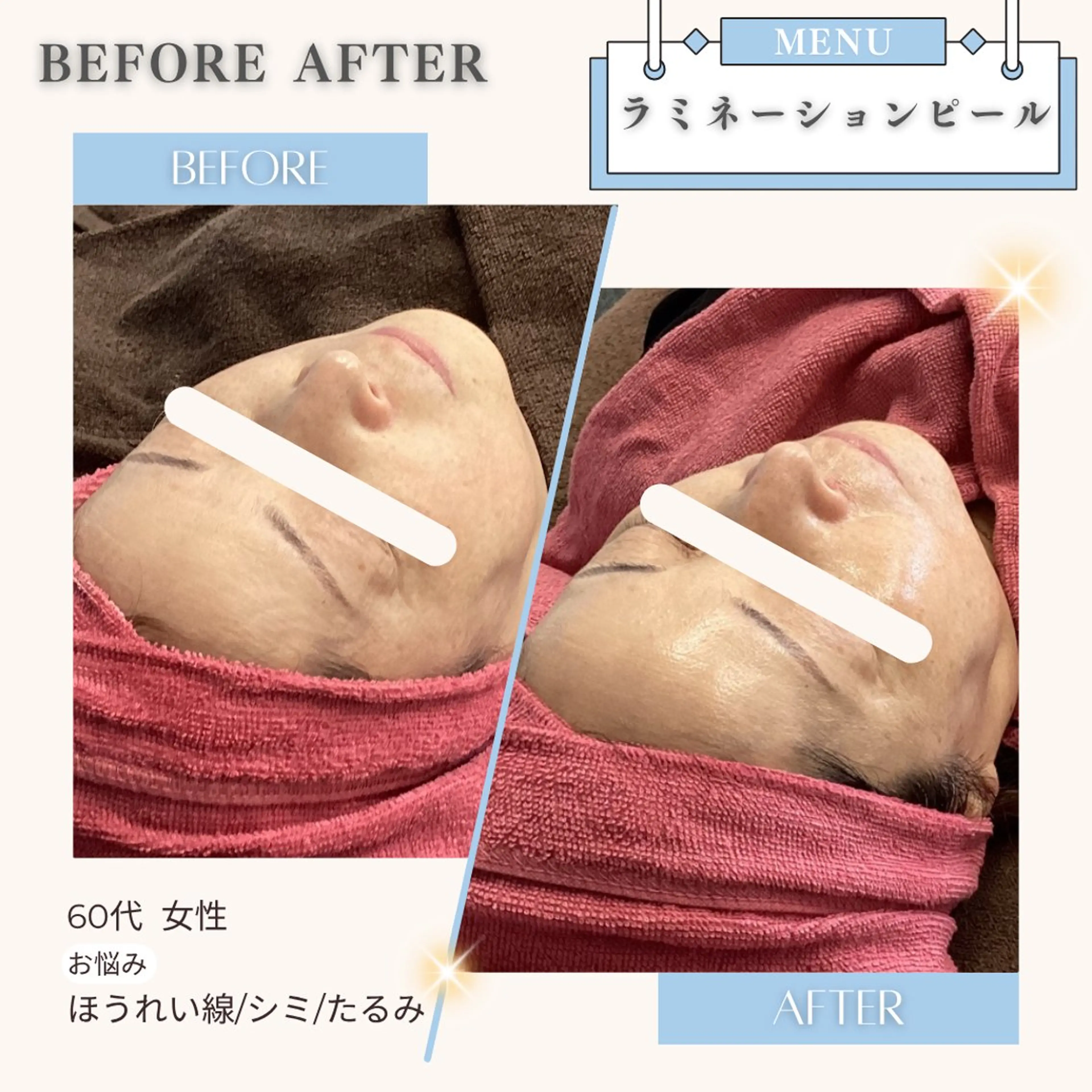 エステ リラク 美白/韓国肌管理 💎 KOTOMIのエステ・リラクイメージ