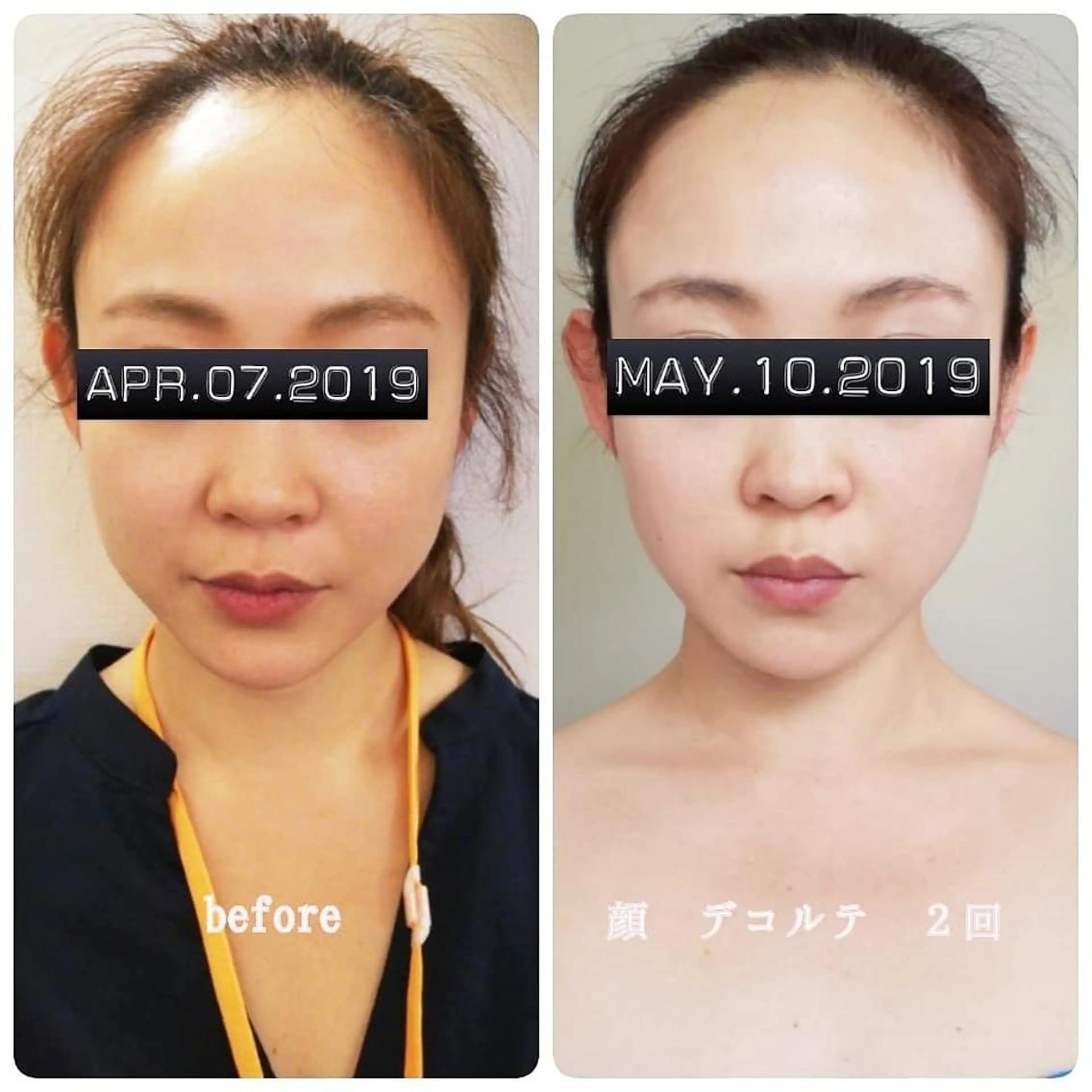 LATTE マツエク&ハイパーナイフ所属・LATTE eyelashのマツエク・マツパデザイン