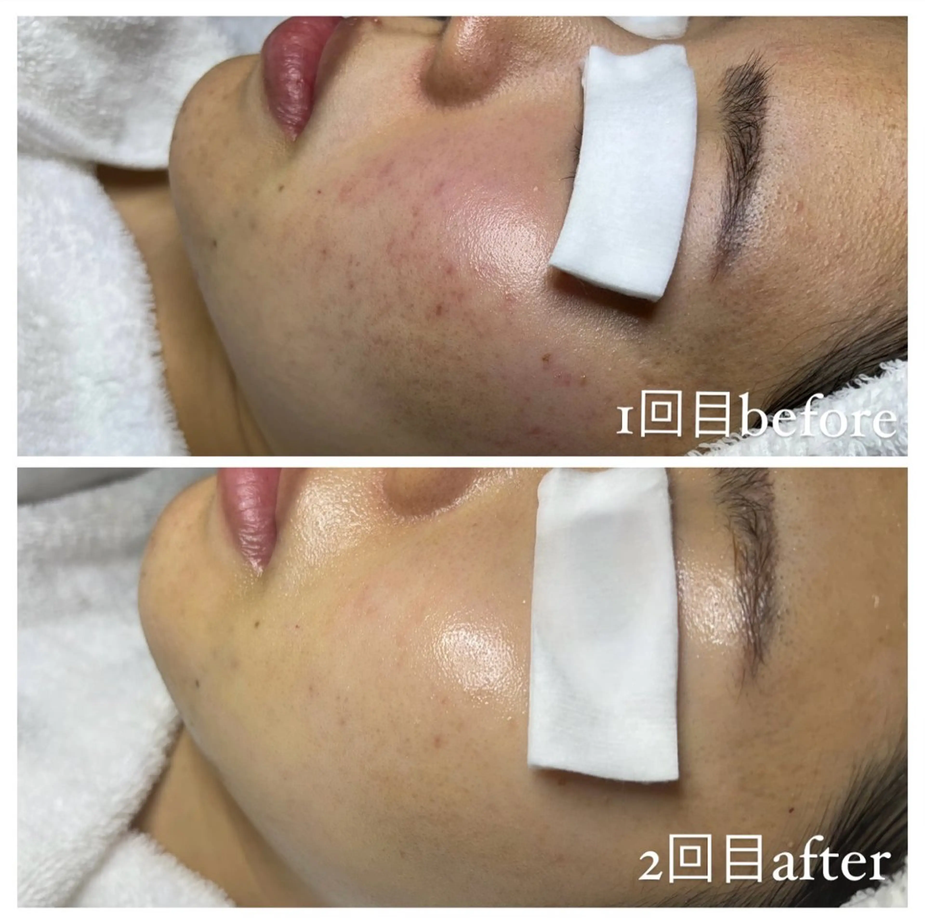 エステ 肌改善・リンパサロン CoCoxiaのエステ・リラクイメージ