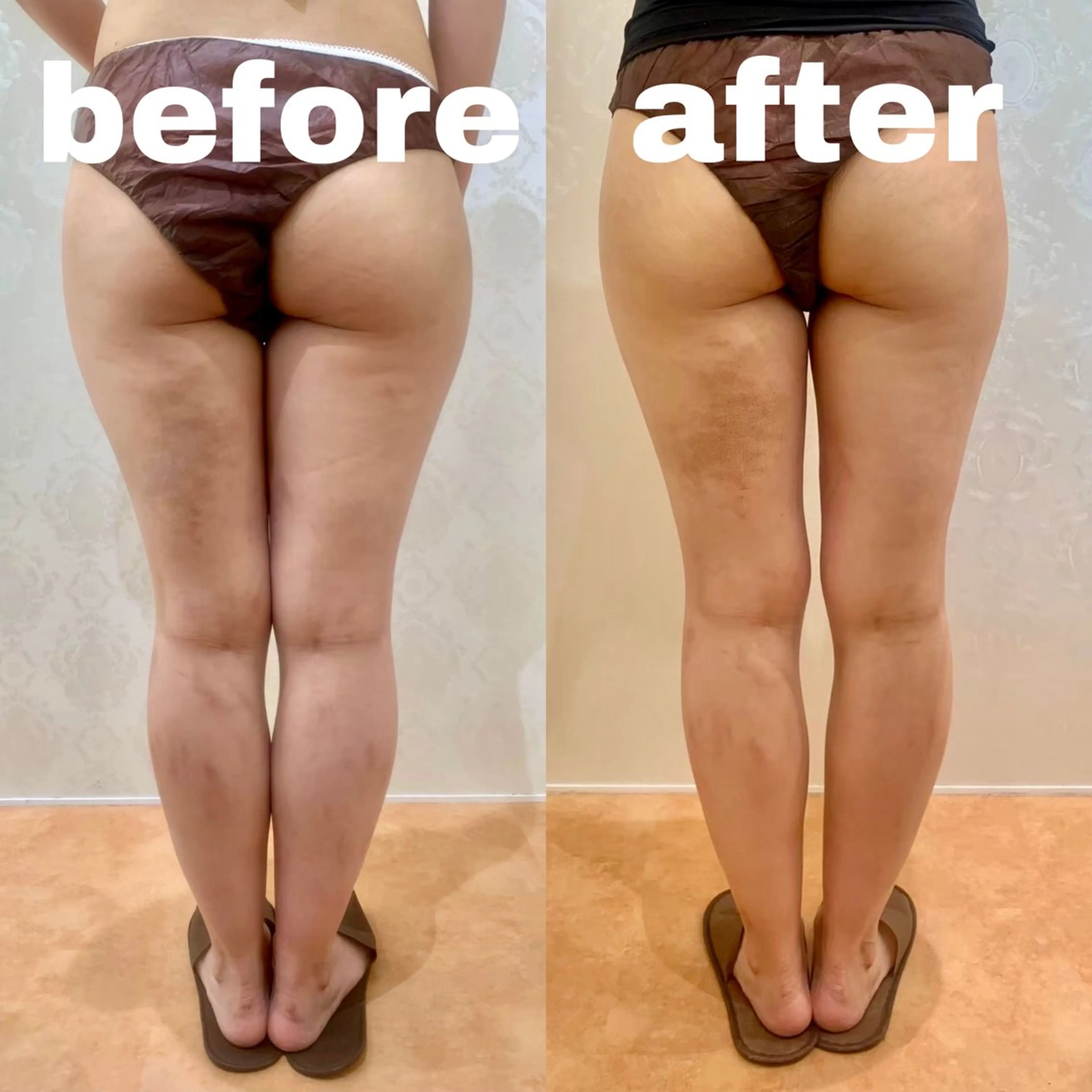 BeauL銀座 村浜友菜🤍のエステ・リラクイメージ