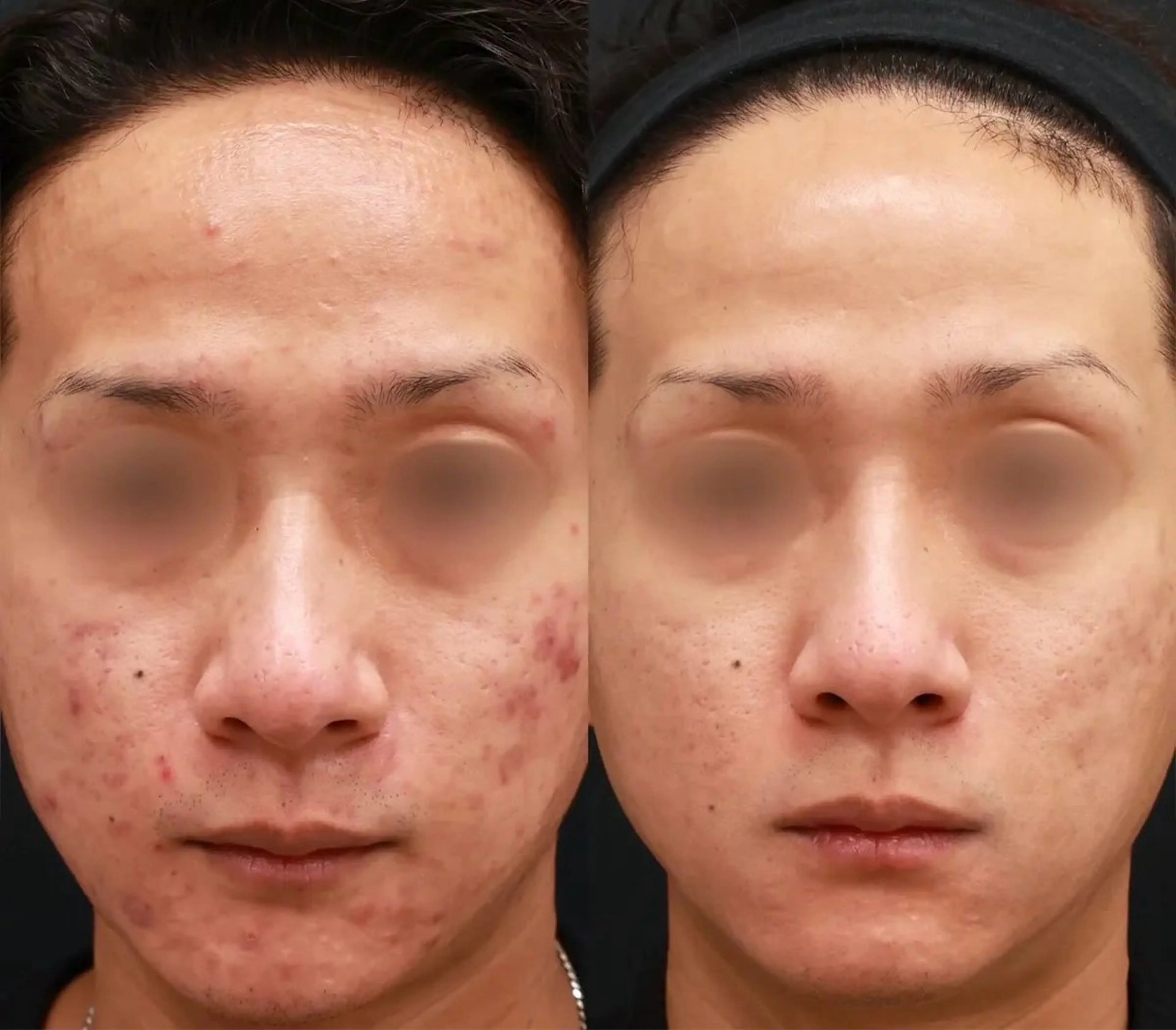 エステ The Esthe .赤坂店のエステ・リラクイメージ