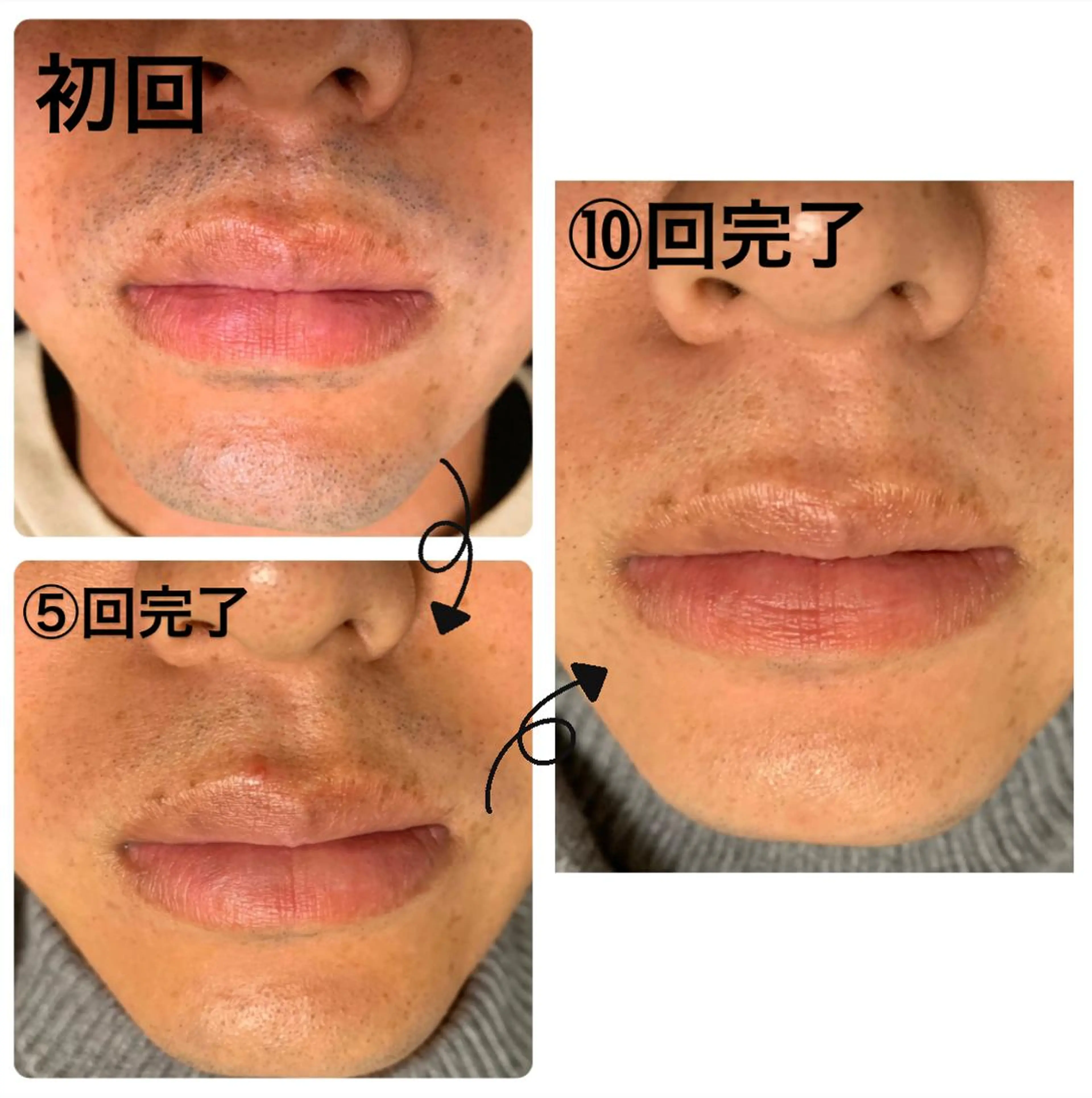 脱毛 メンズ脱毛サロン Le falcoのエステ・リラクイメージ