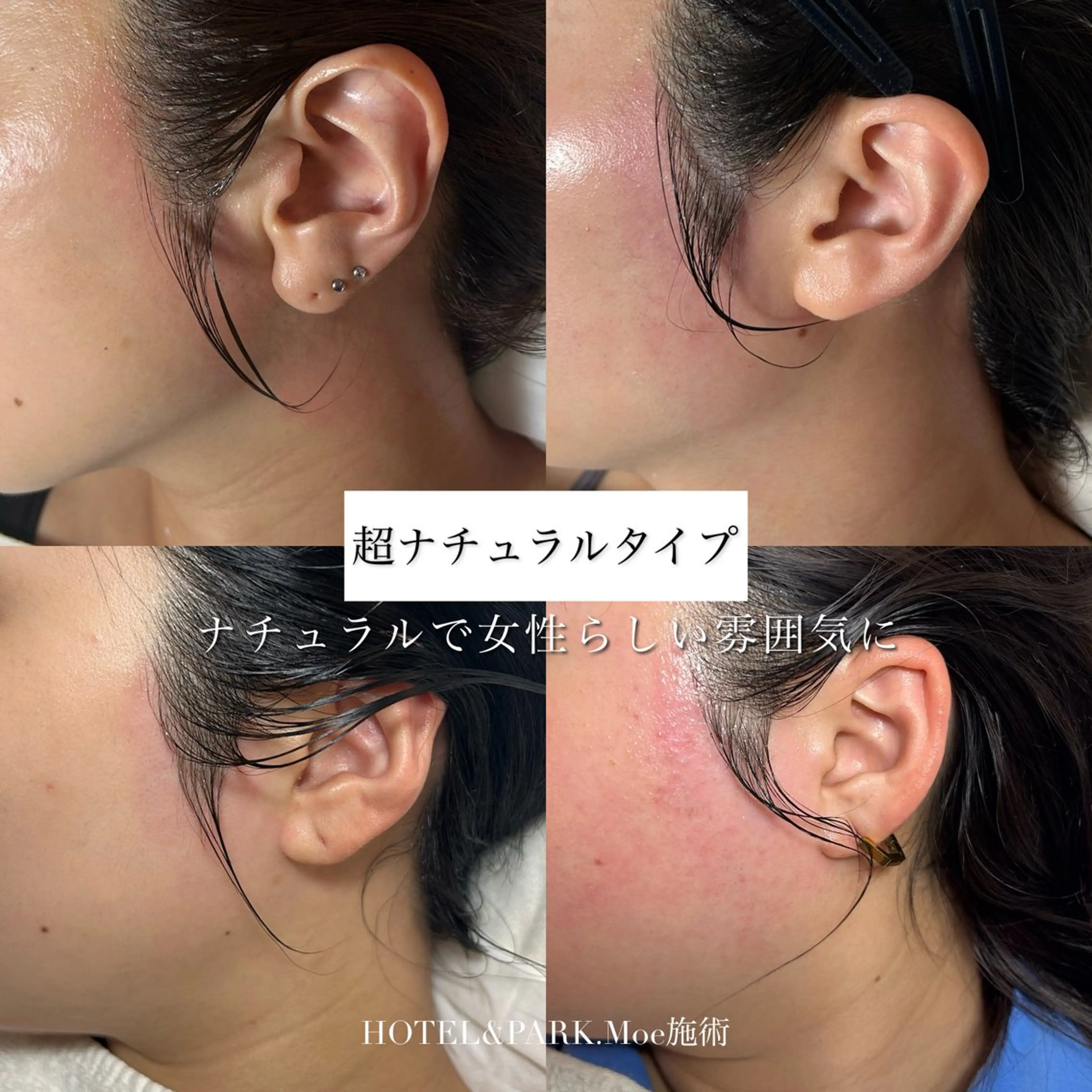 HOTEL&PARK .Moeワックス脱毛のエステ・リラクイメージ