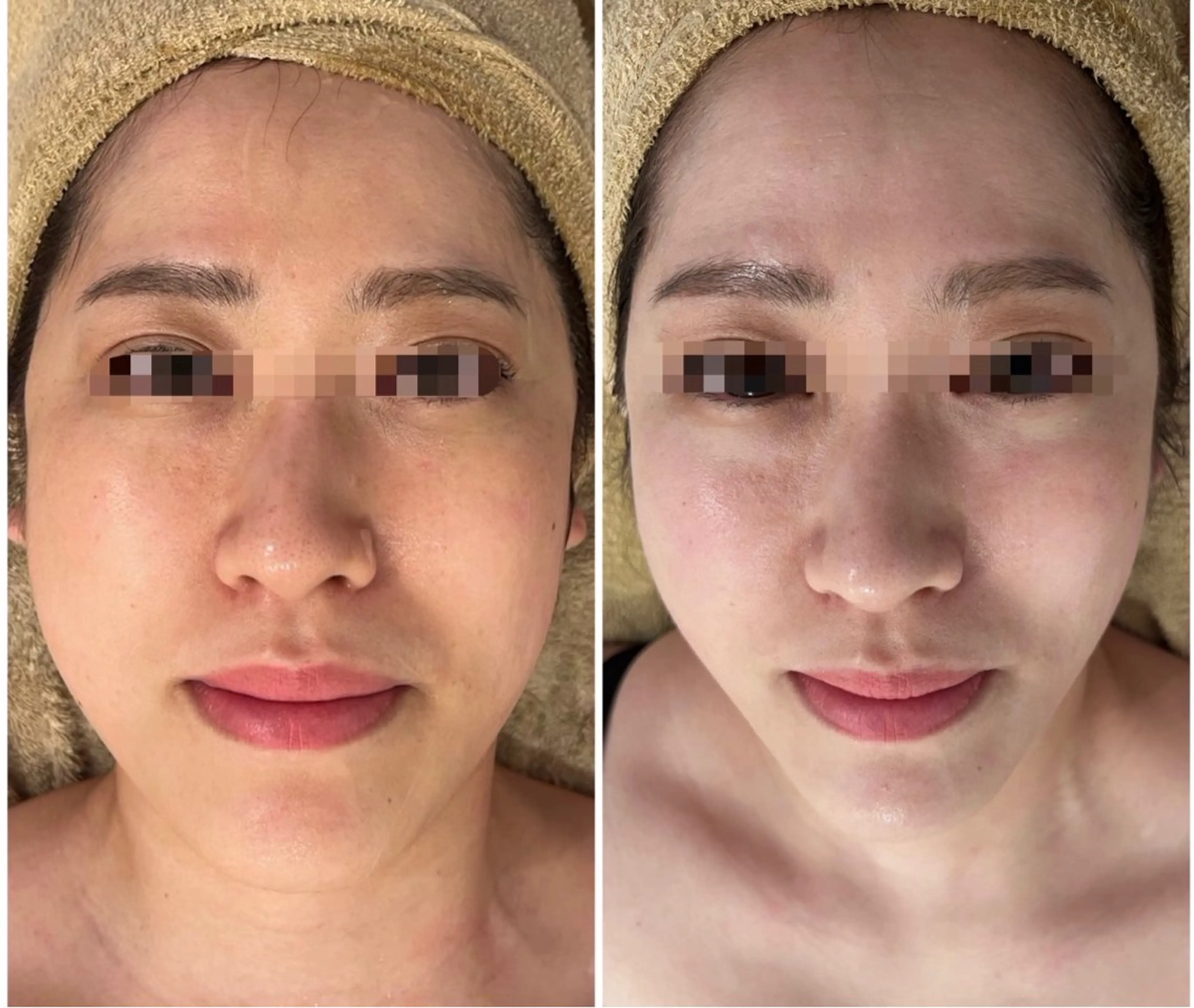 【小顔痩身専門看護師 サロンSONA】のエステ・リラクイメージ