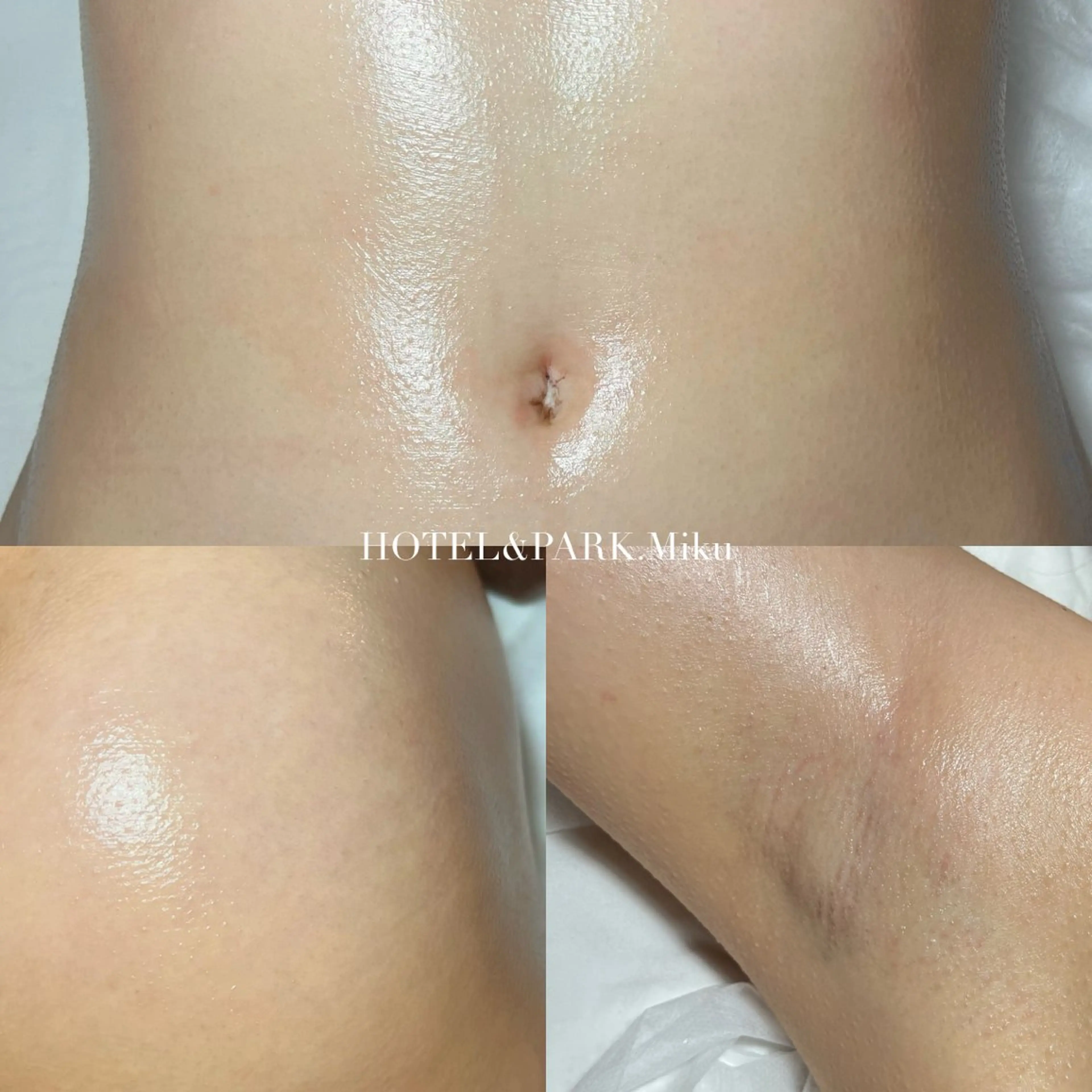 HOTEL&PARK . ワックス脱毛のエステ・リラクイメージ
