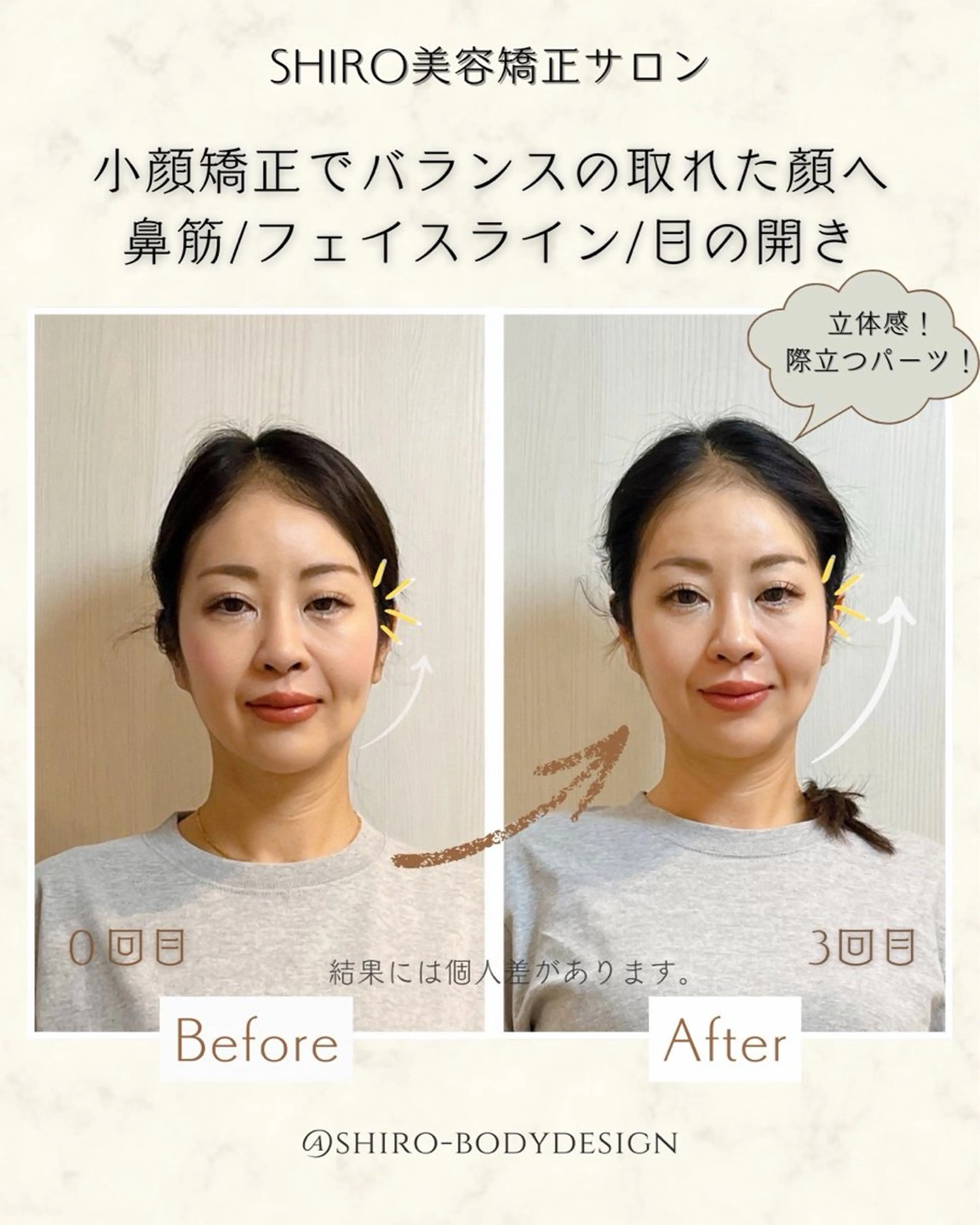 小顔矯正勝山式 shiroしろのエステ・リラクイメージ