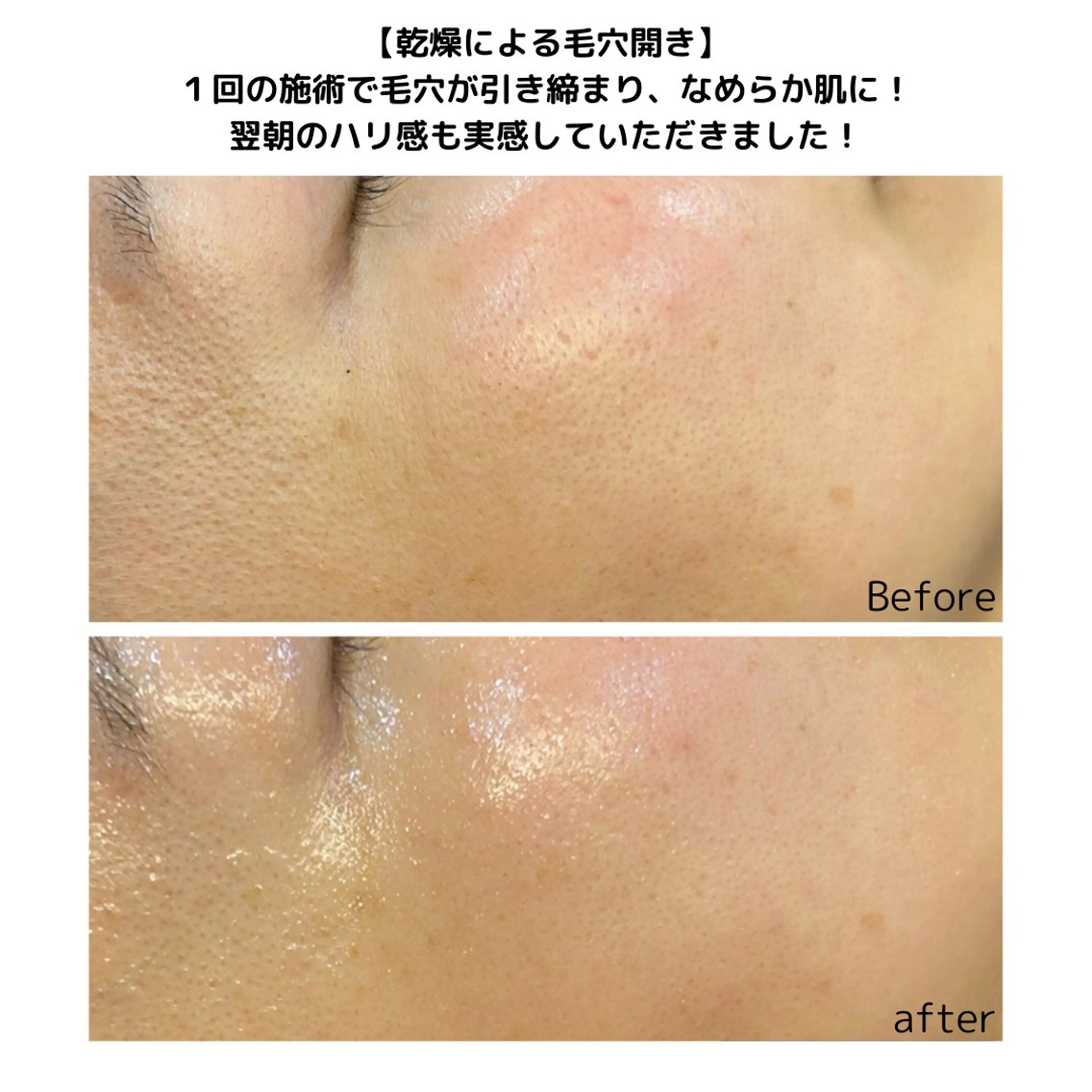 leolo武蔵浦和 肌質改善＆脱毛のエステ・リラクイメージ