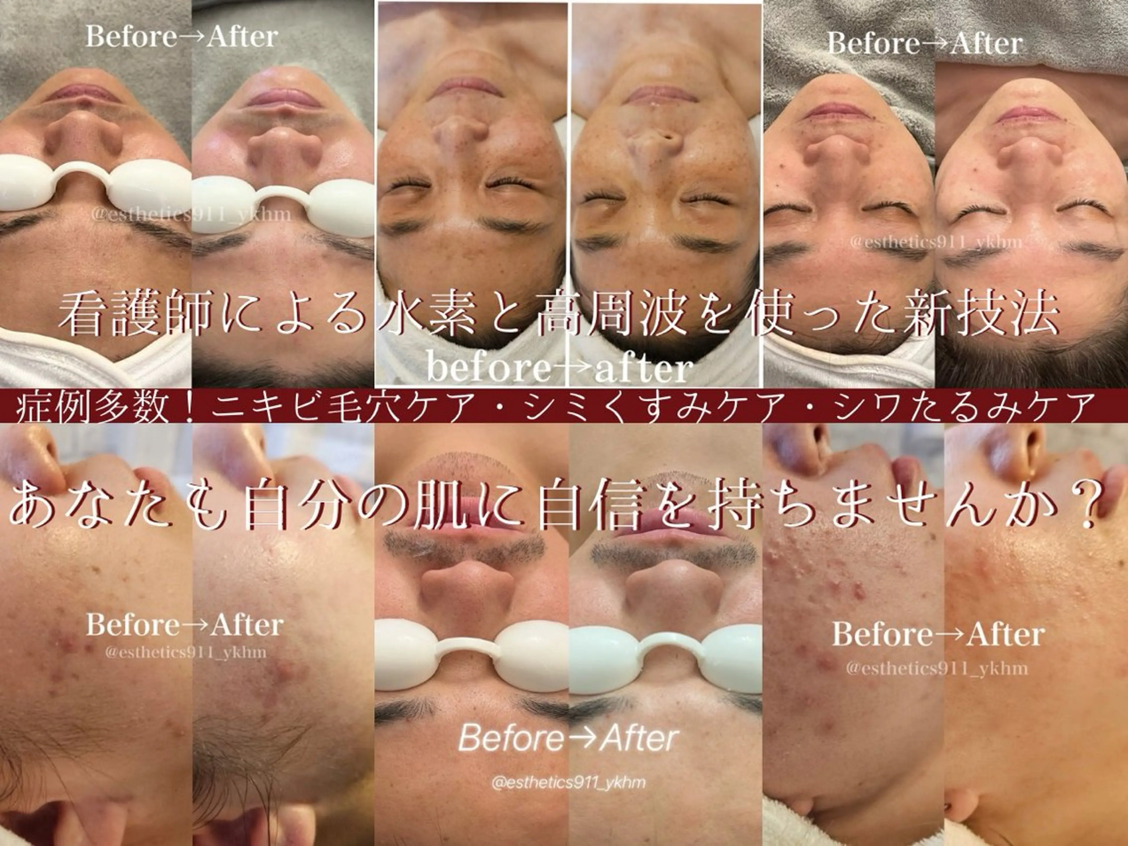 エステ リラク Esthetics 911横浜のエステ・リラクイメージ