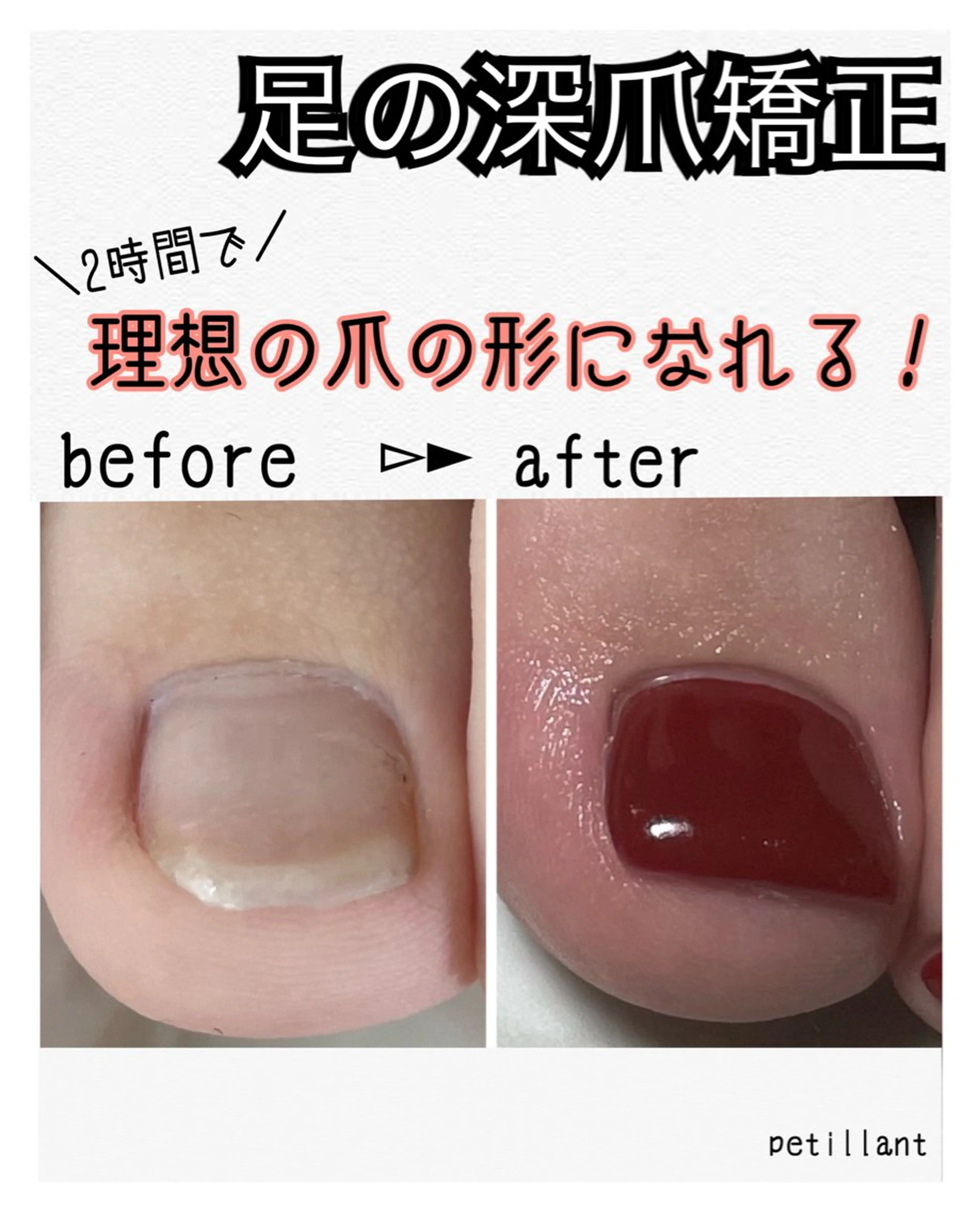 ネイル 長さ出し nail salon petillantのネイルデザイン