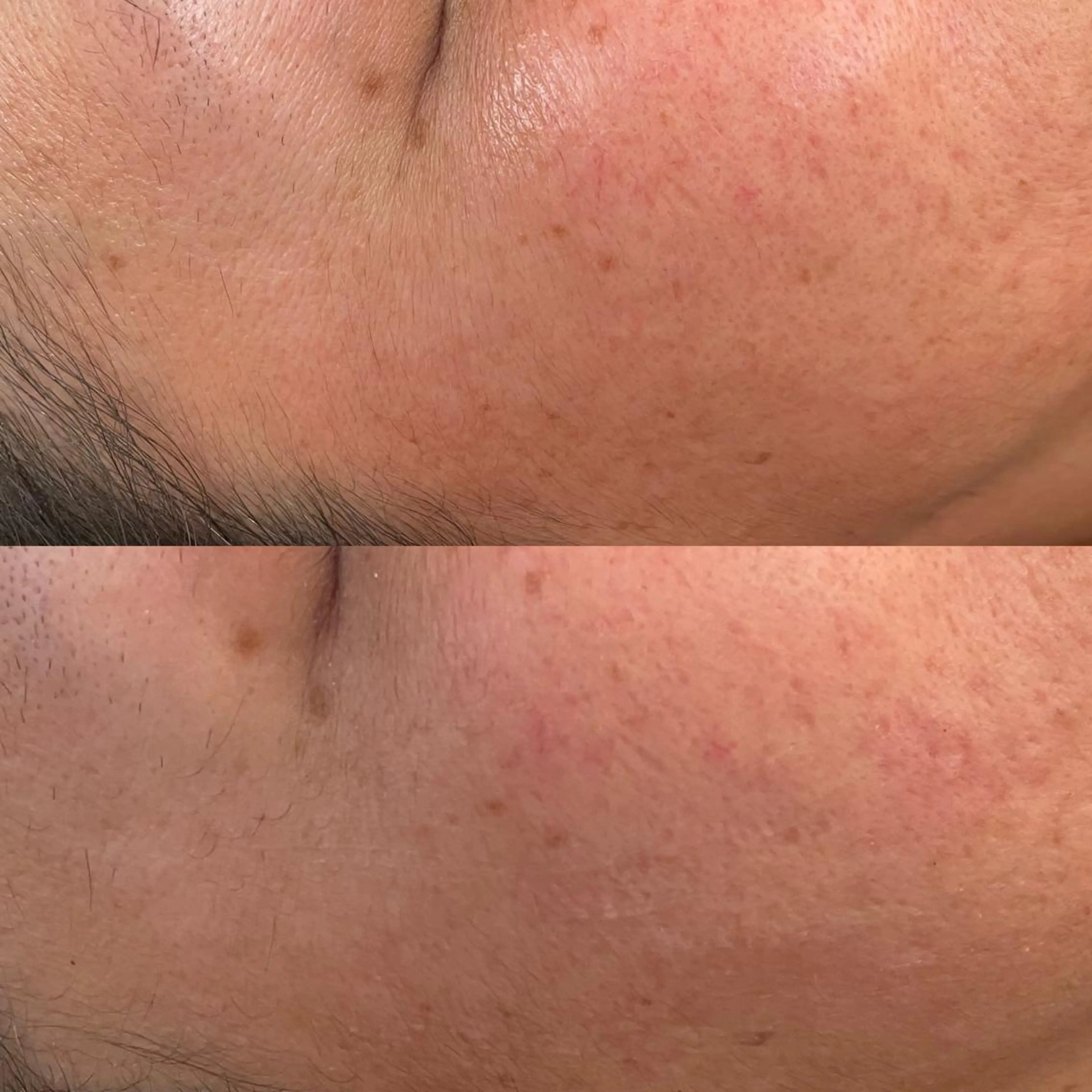 VERY VERY 九条店のエステ・リラクイメージ