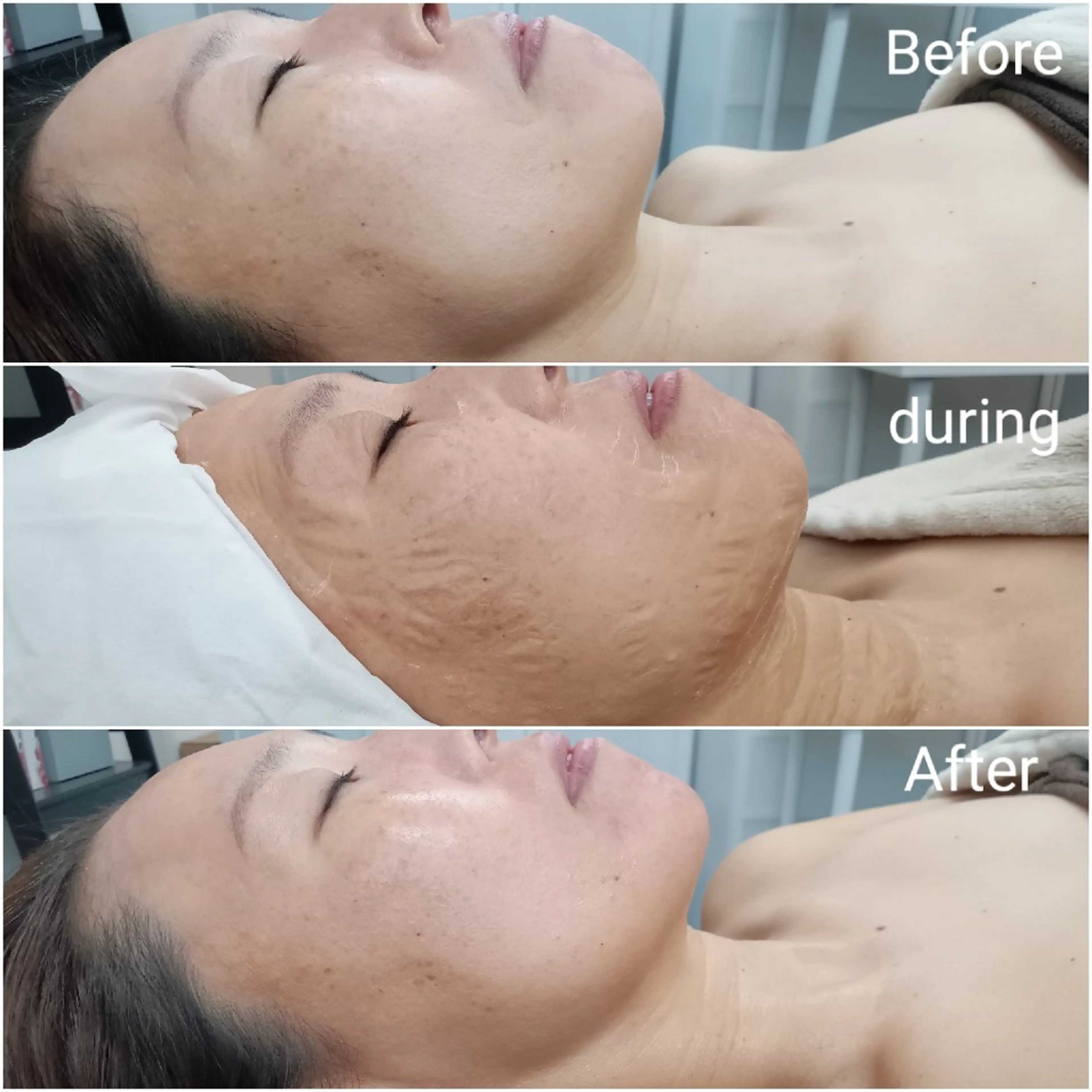 エステ リラク 肌質改善Beauty salon Renのエステ・リラクイメージ