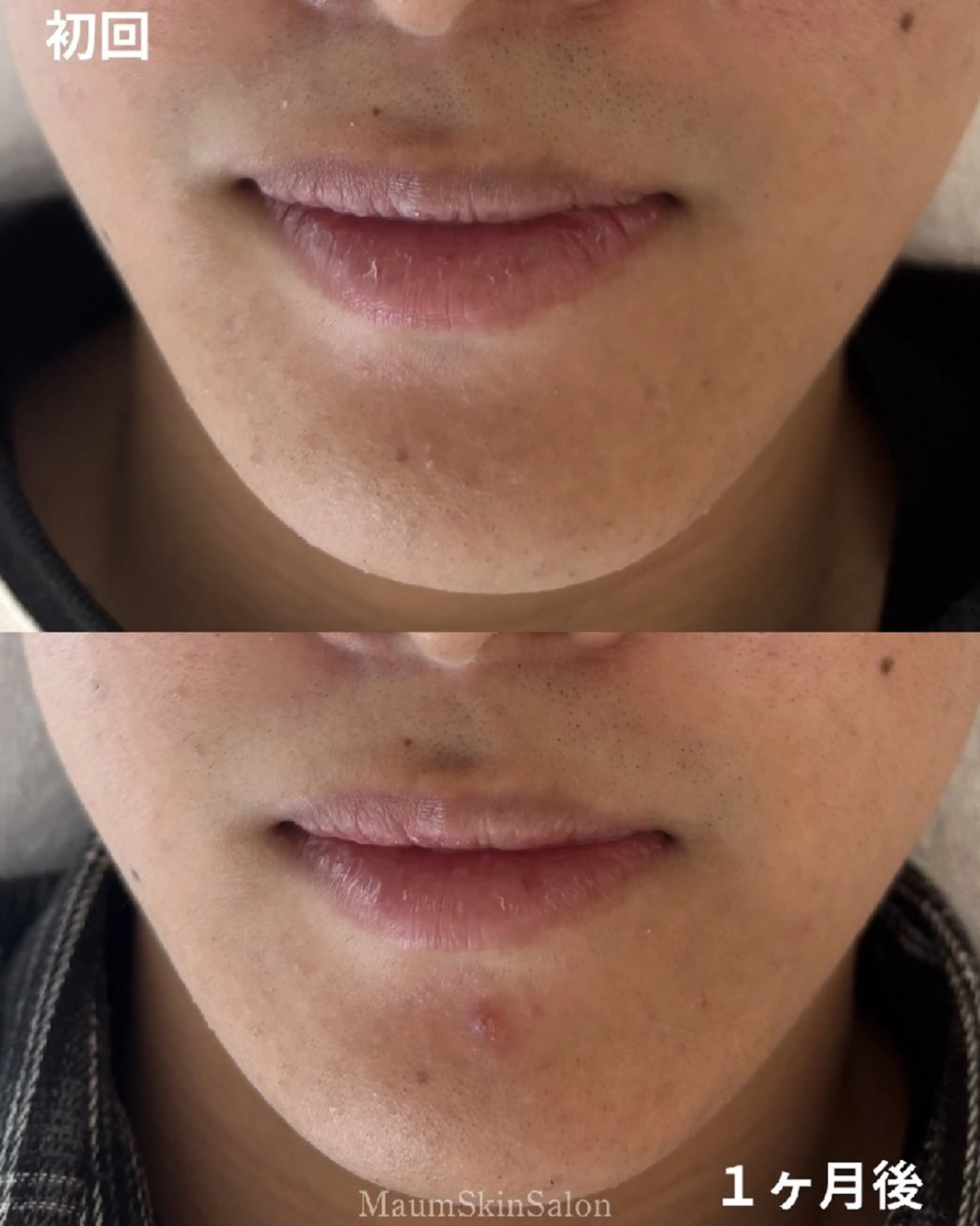 メンズ 脱毛 Maum SkinSalonのエステ・リラクイメージ