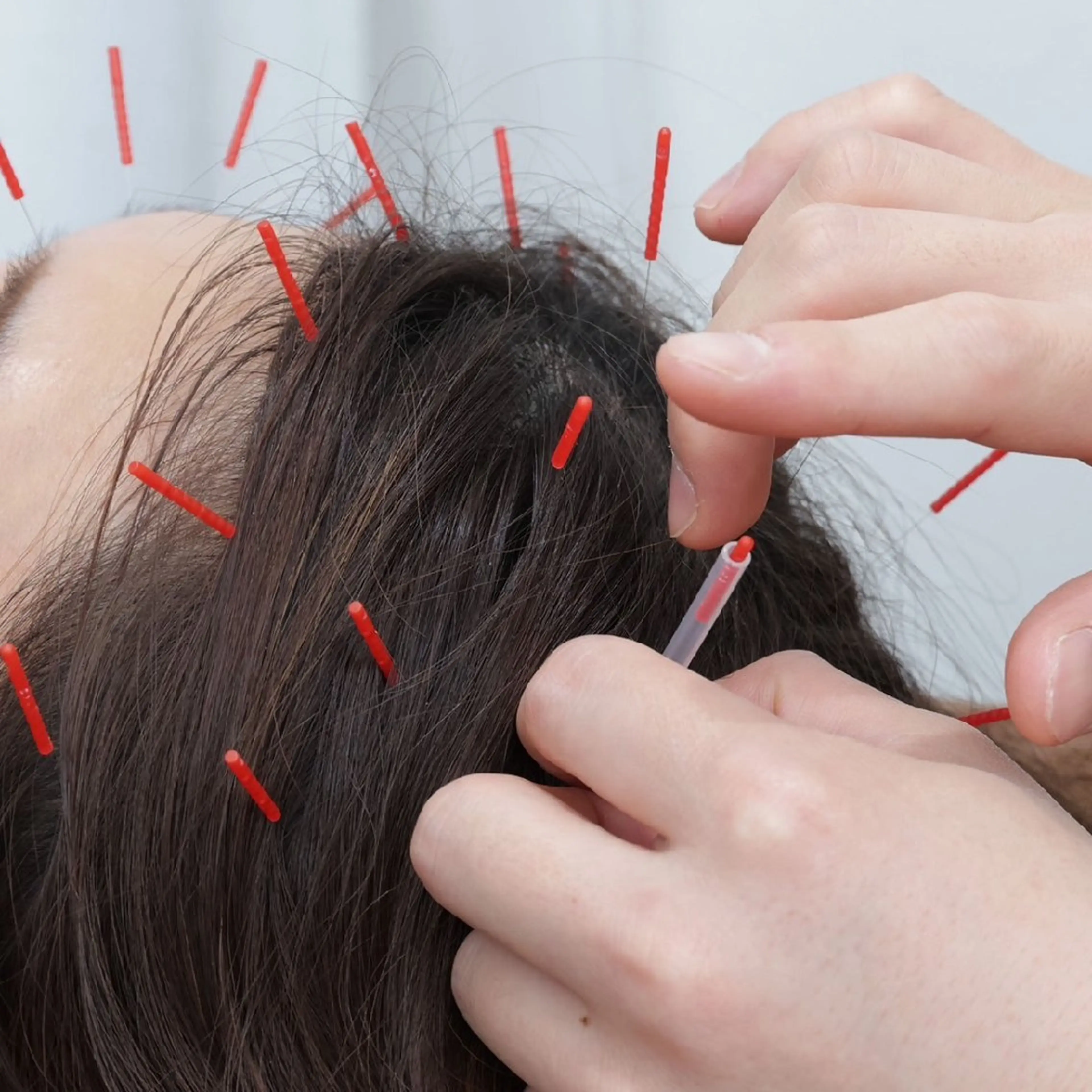 メンズ エステ リラク Spring鍼灸院 ✨首肩こり、腰痛に！のその他イメージ