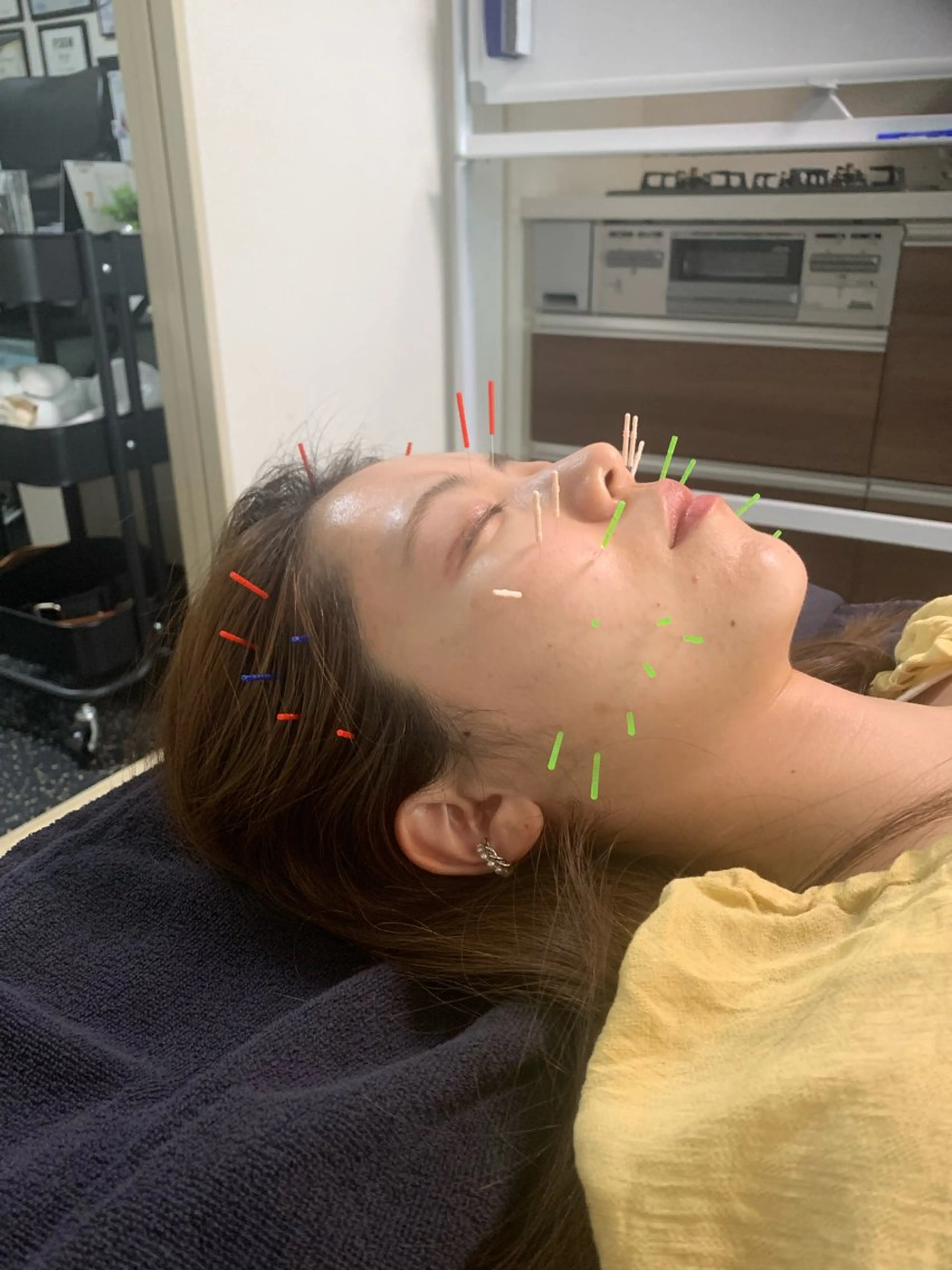 エステ リラク 小顔矯正・美容鍼 FLOW鍼灸整体院のエステ・リラクイメージ