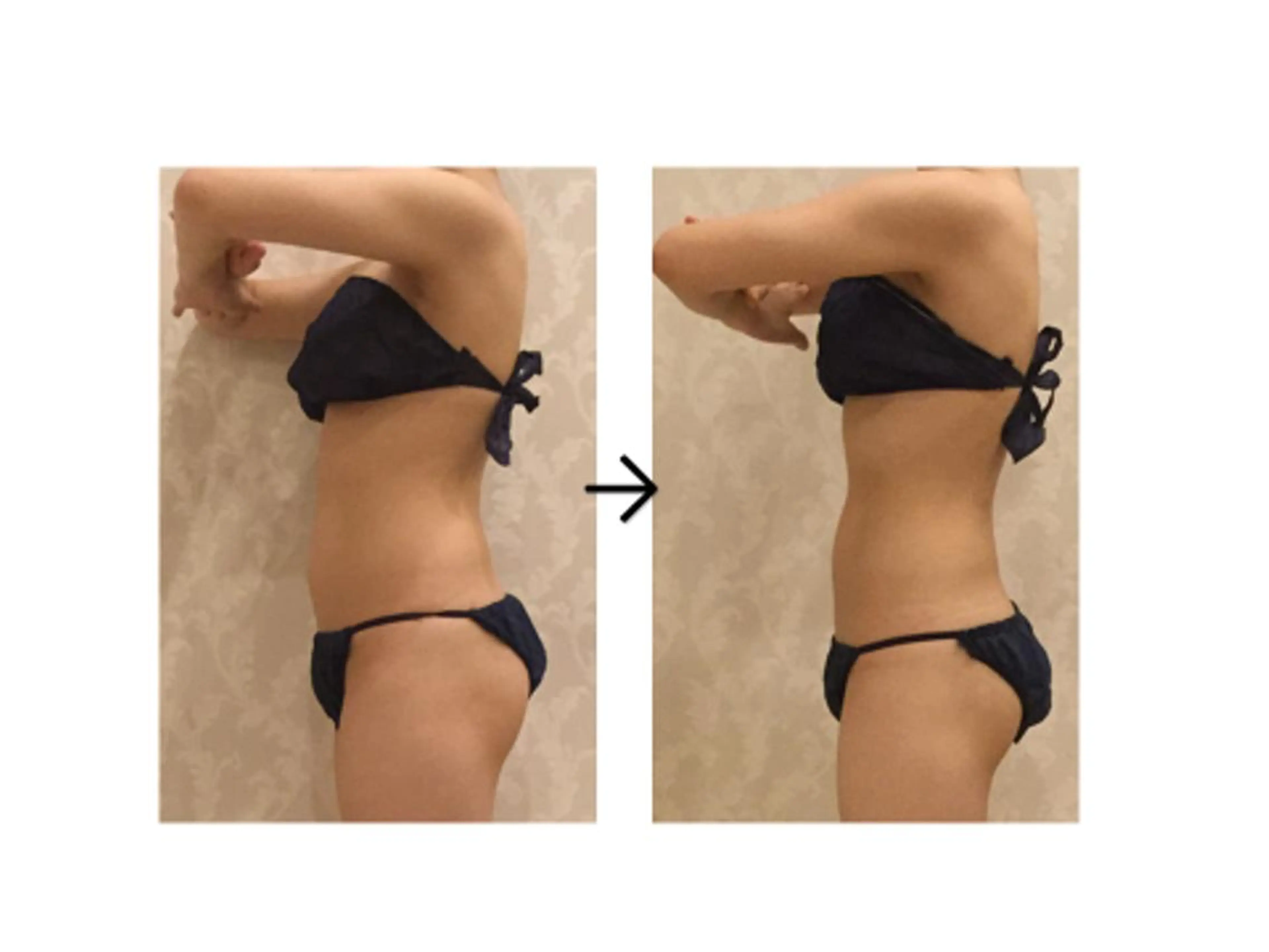 🌟全身すっきりサイズダウン🌟オーダーメイドボディケア¥4980の写真