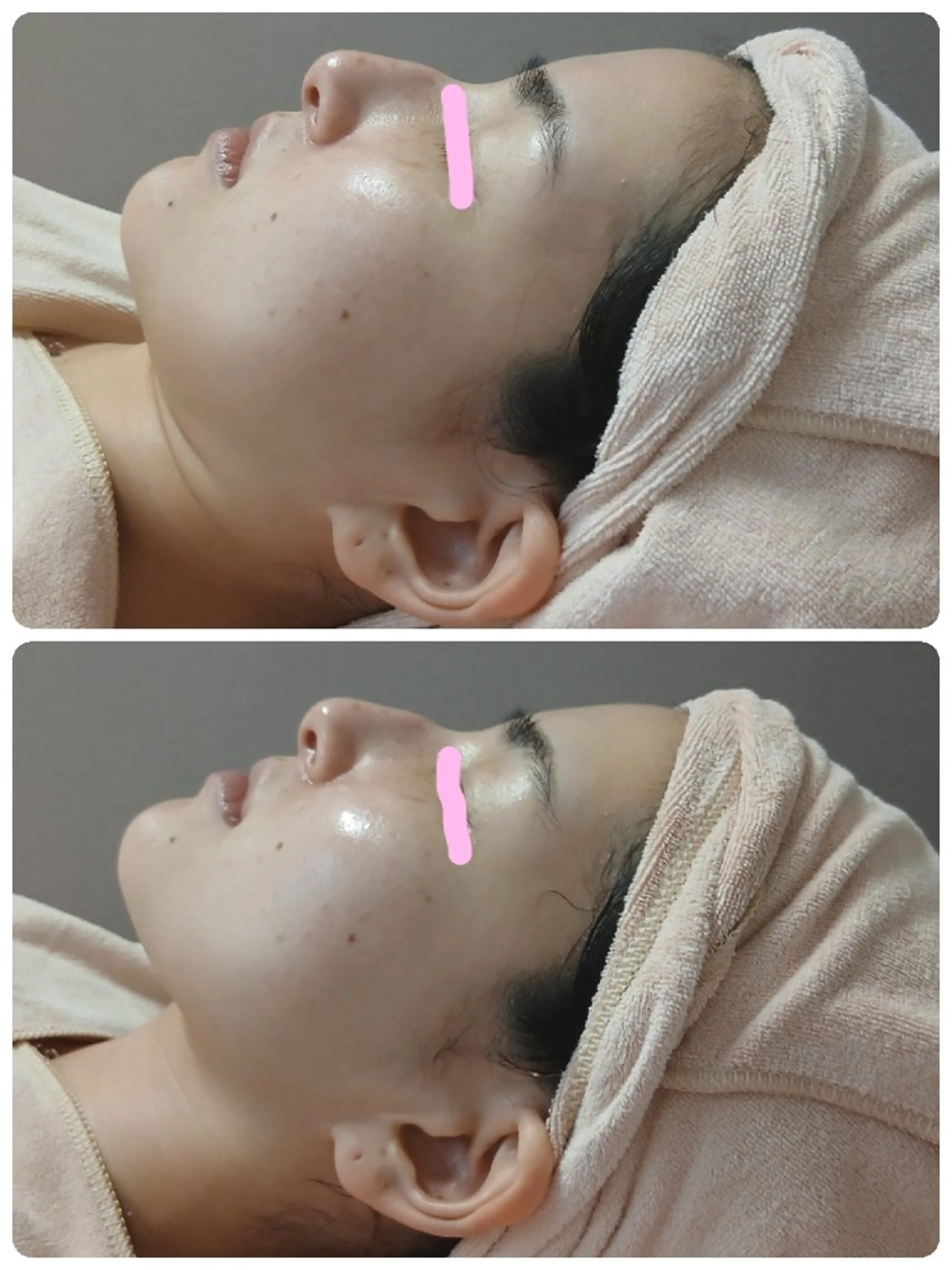 エステ 小顔エステ サクラ🌸ベルのエステ・リラクイメージ