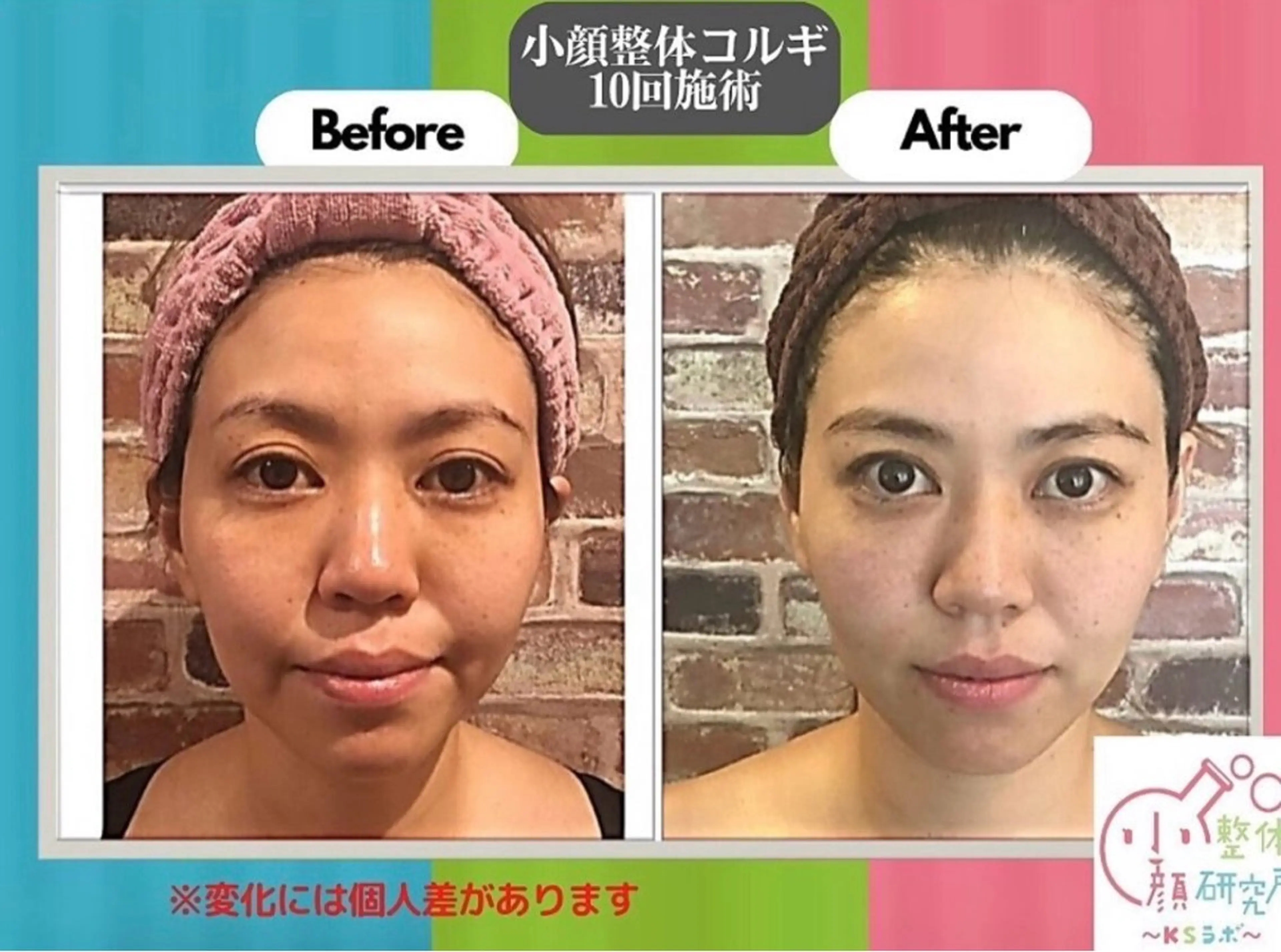 ①小顔整体研究所 【KSラボ】町田店のエステ・リラクイメージ