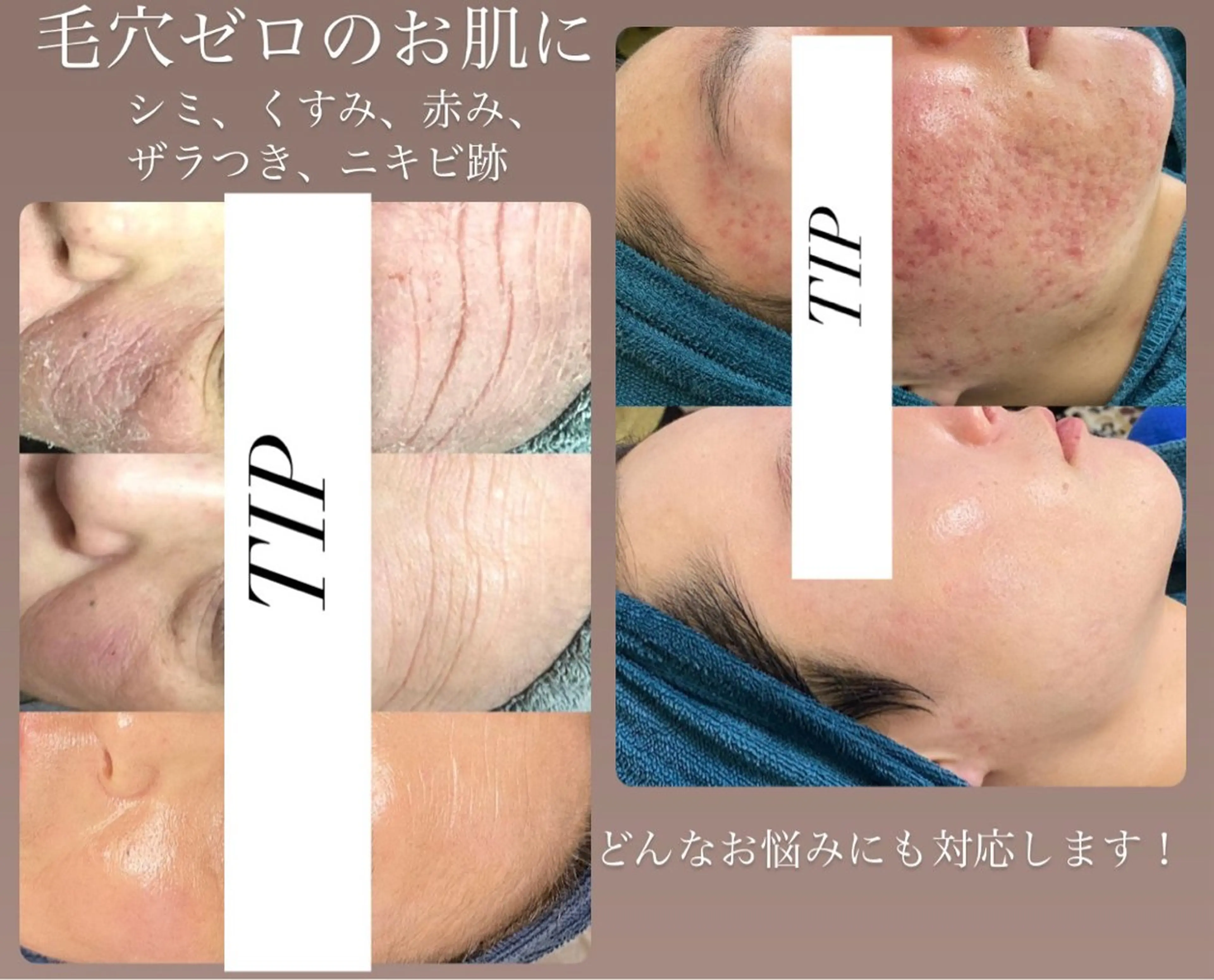 エステ 美肌管理サロン　ペルボヌール所属・韓国美肌管理サロン ペルボヌールのエステ・リラクイメージ